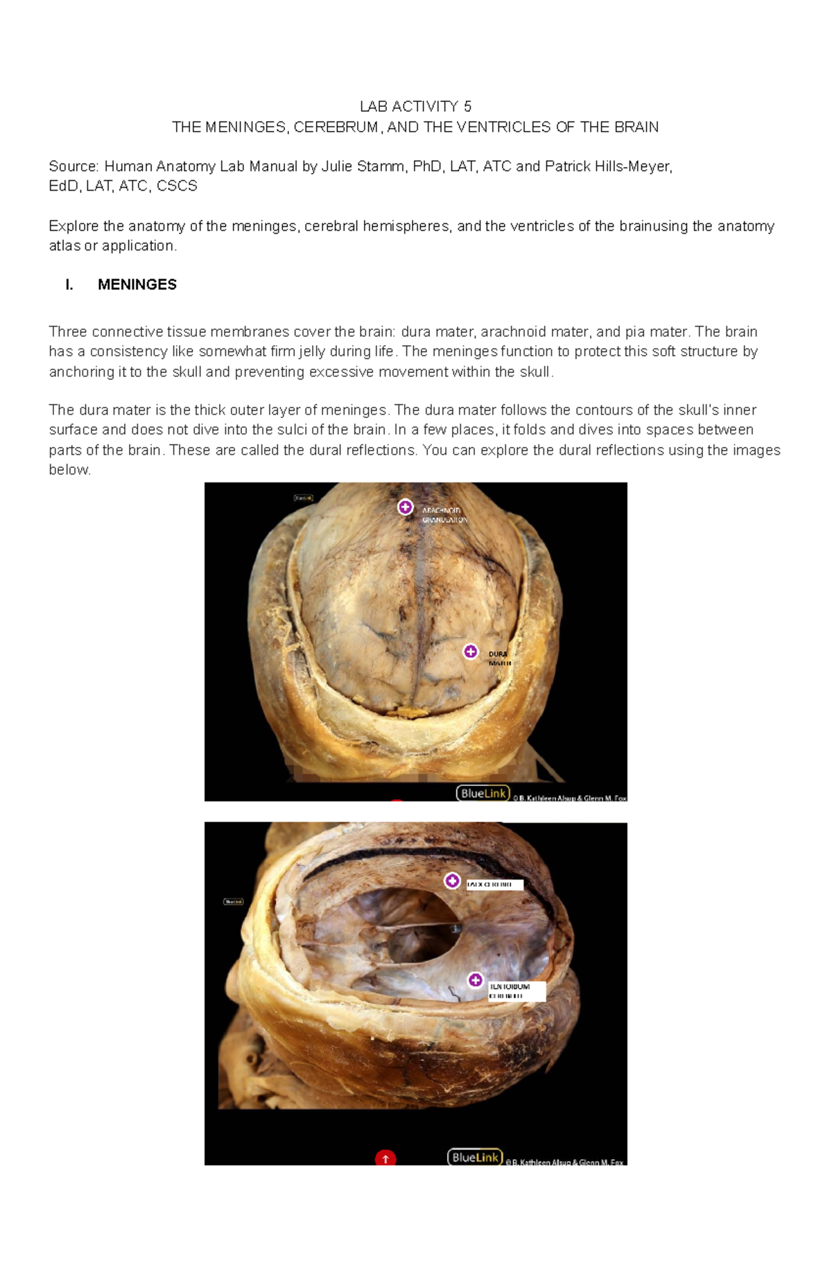 general anatomy - LAB ACTIVITY 5 THE MENINGES, CEREBRUM, AND THE ...