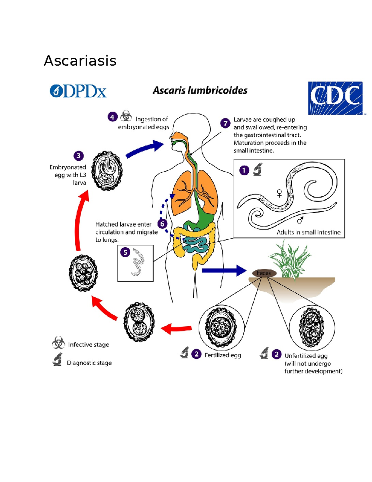 Ascariasis Overview and Hookworm (Intestinal) Summary - Studocu
