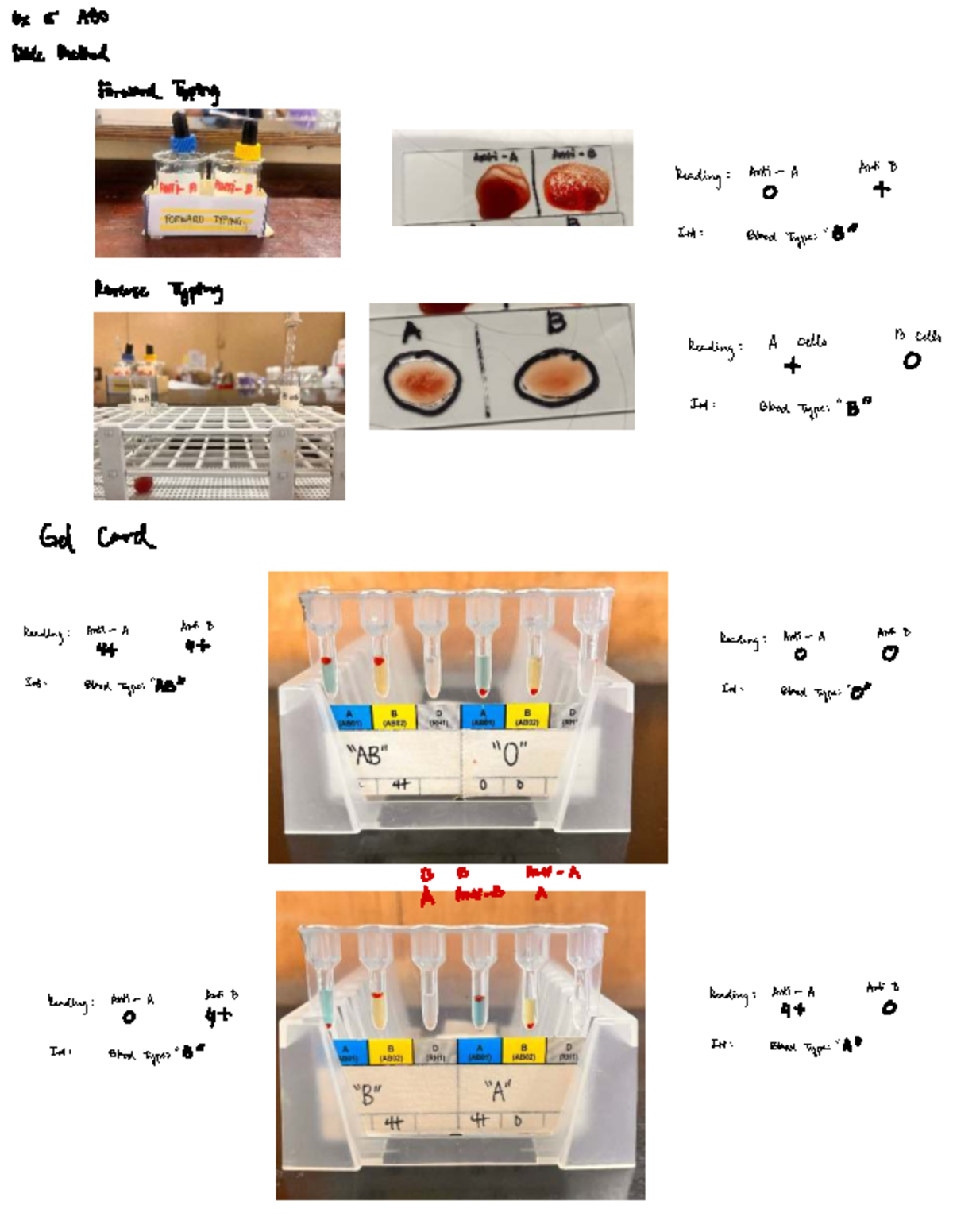 Ex 5 bloodtyping - Pracs - Ex 5 ABO Slide Method ForwardTyping Reading ...