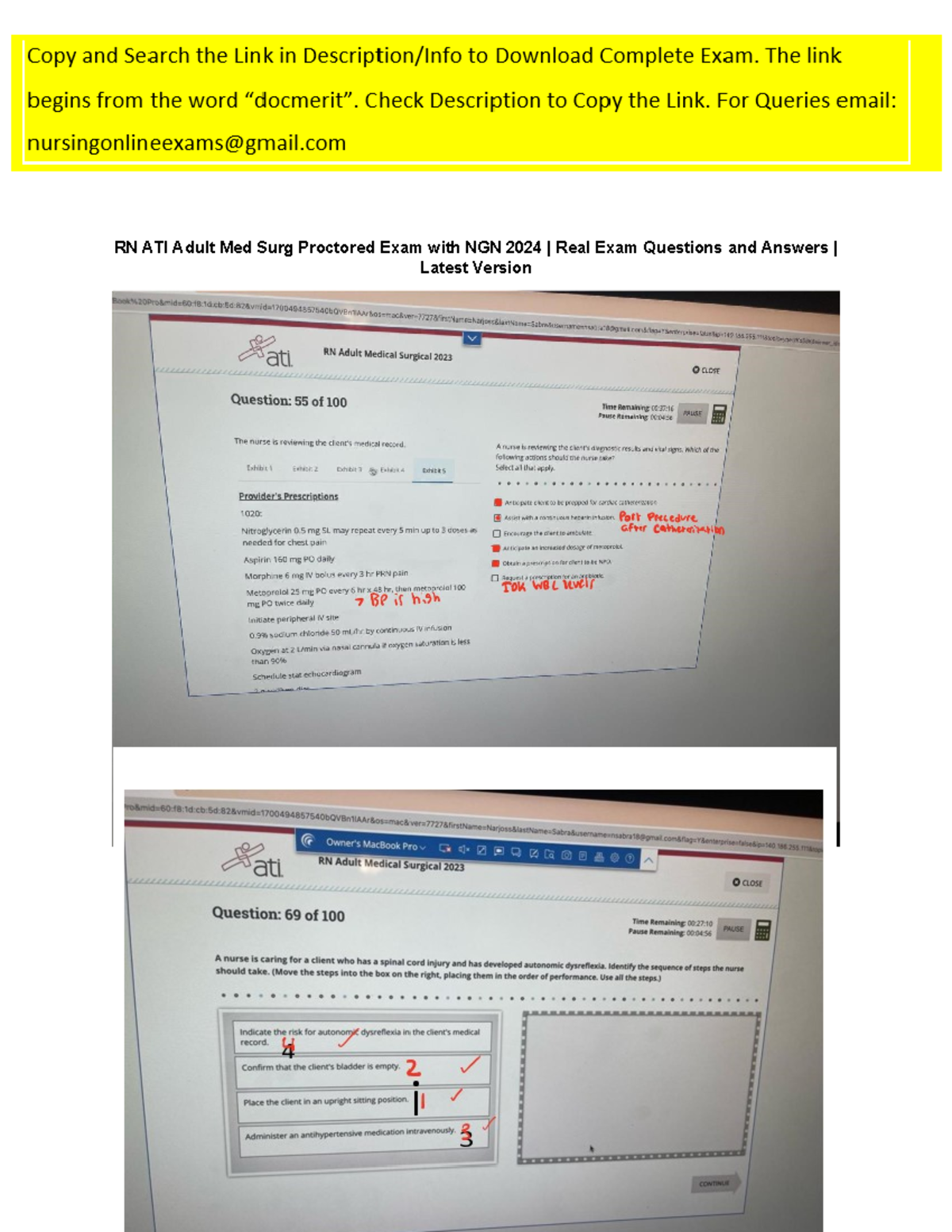 RN ATI Adult Med Surg Proctored Exam With NGN 2024 Real Exam Questions ...