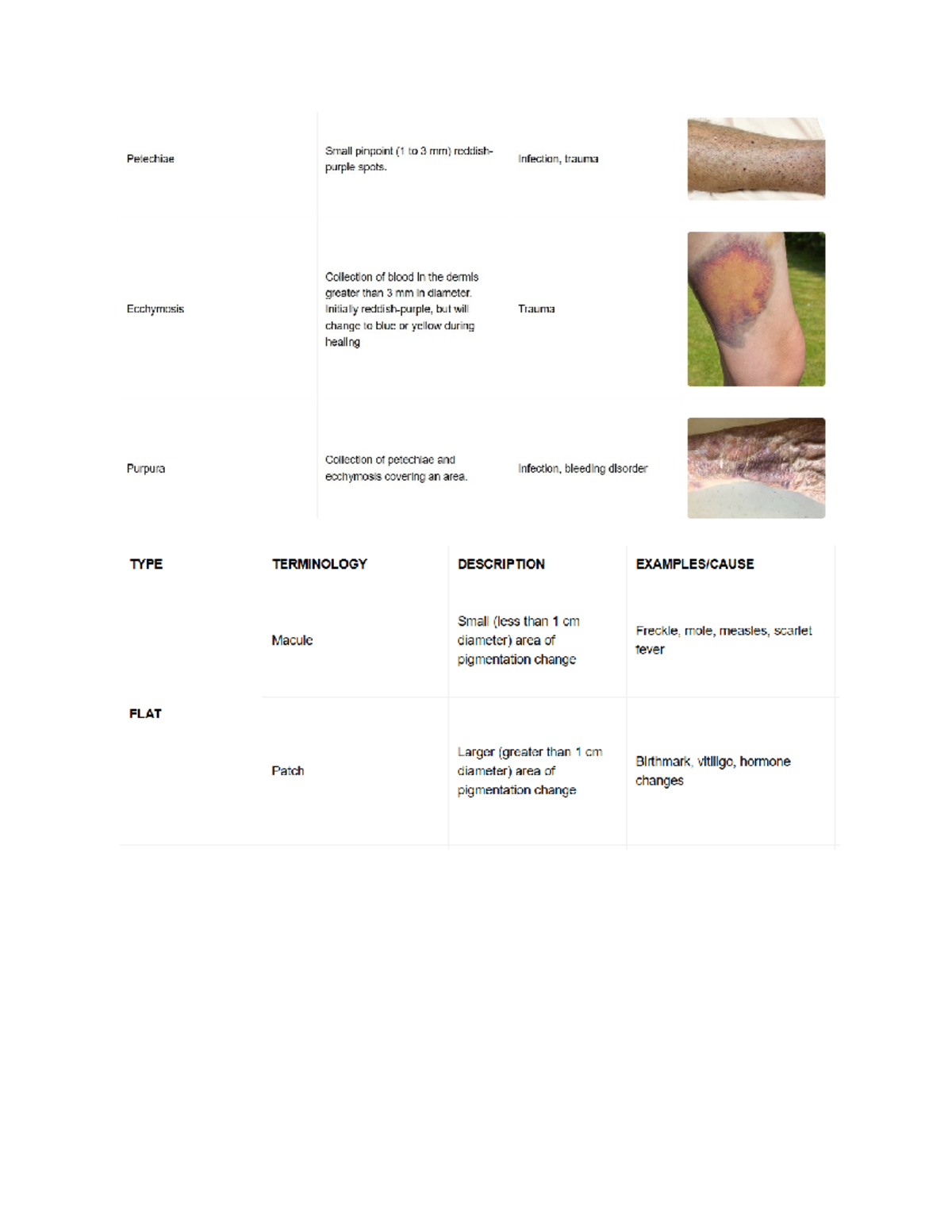 Notes- module 4- health assessment - Small pinpoint (1 to 3 mm ...