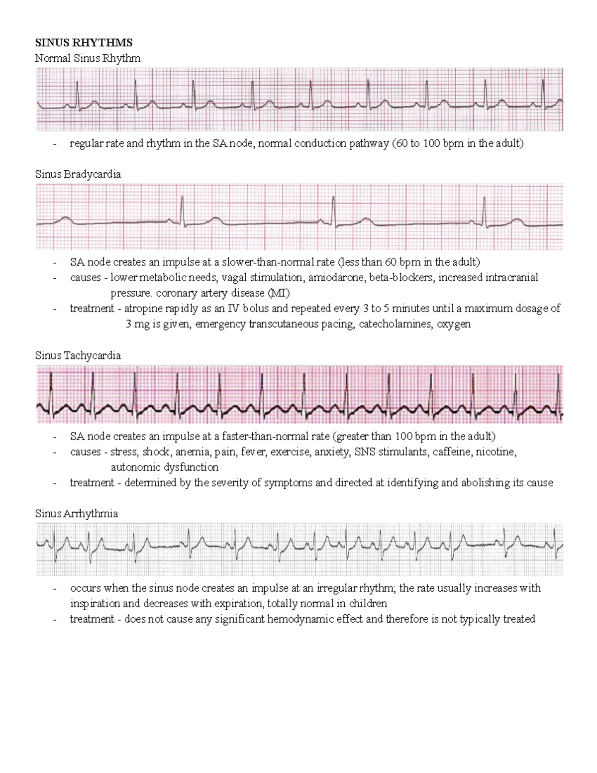 EXAM 2 - exam 2 - SINUS RHYTHMS Normal Sinus Rhythm regular rate and ...
