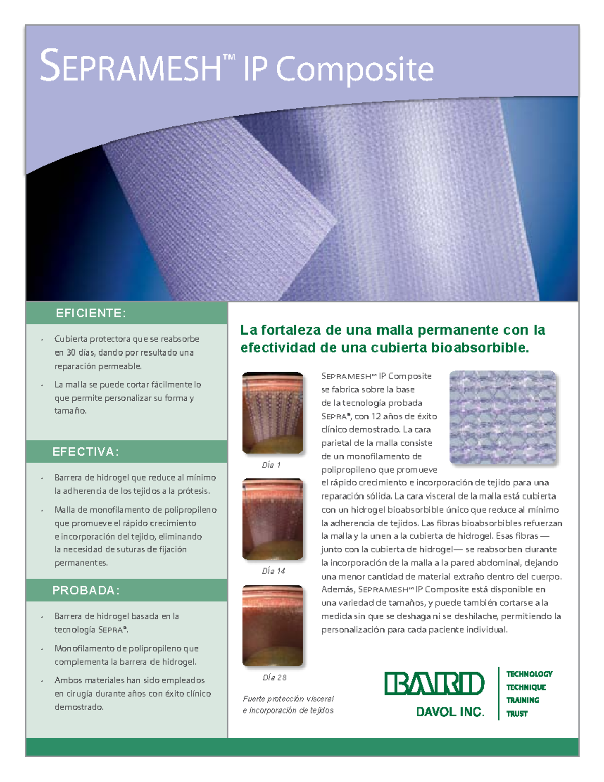 SEPRAMESH™ IP Composite: Eficiencia y Efectividad en Rehabilitación ...