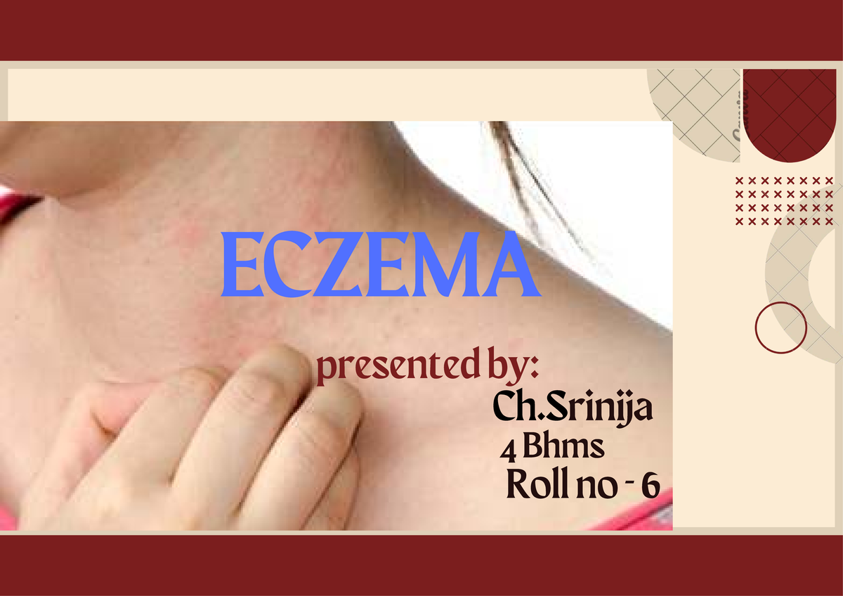 ECZEMA Overview and Classification - BHMS 4th Year Notes - Studocu