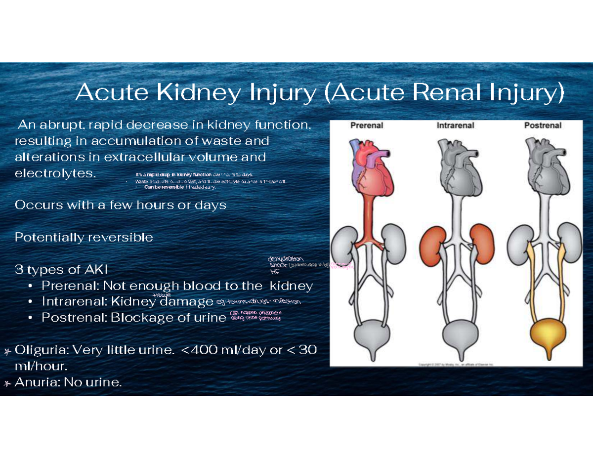 AKI Overview: Types, Causes, and Management Strategies - Studocu