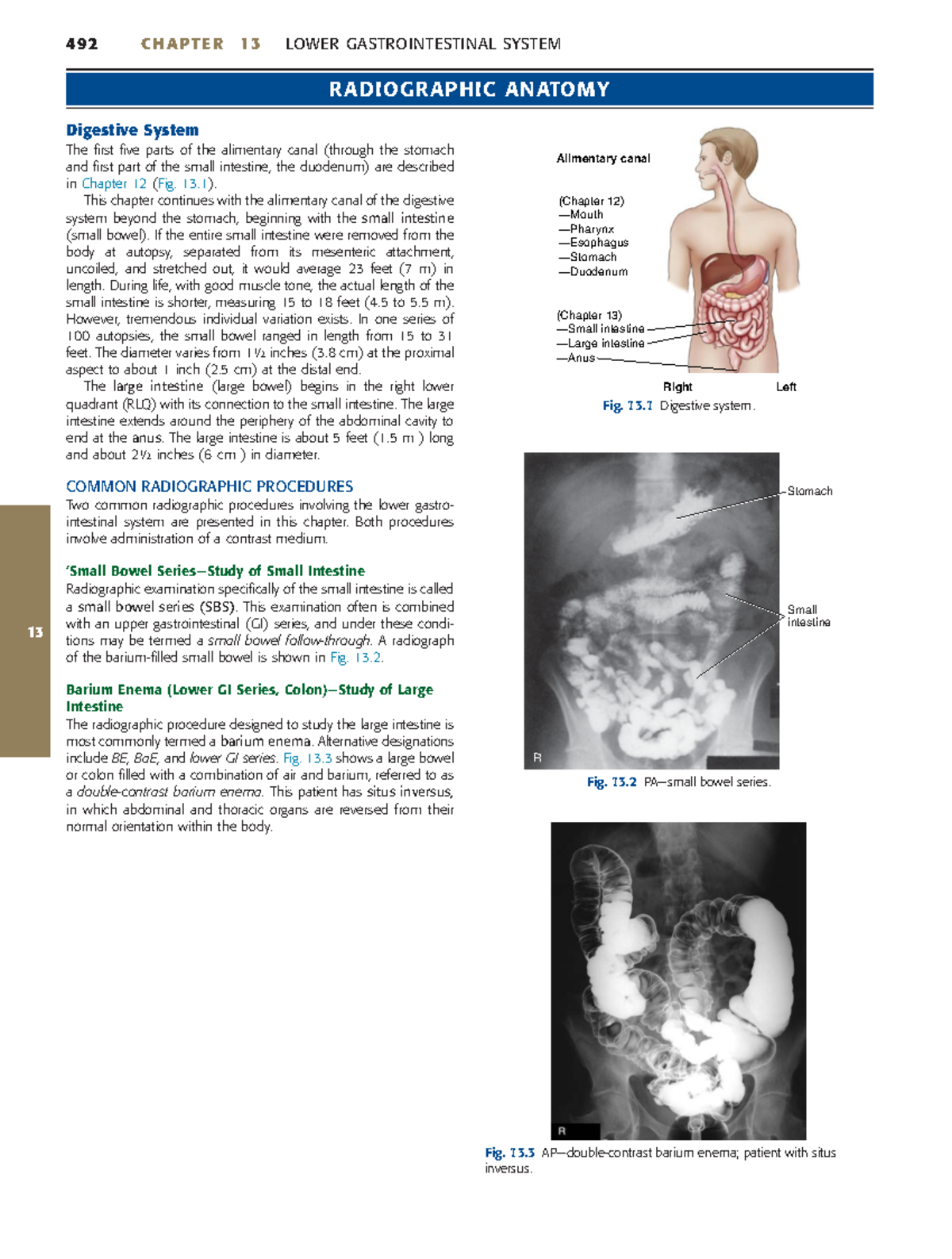 Common Radiographic Procedures: Lower GI System - Ch. 13 Overview - Studocu