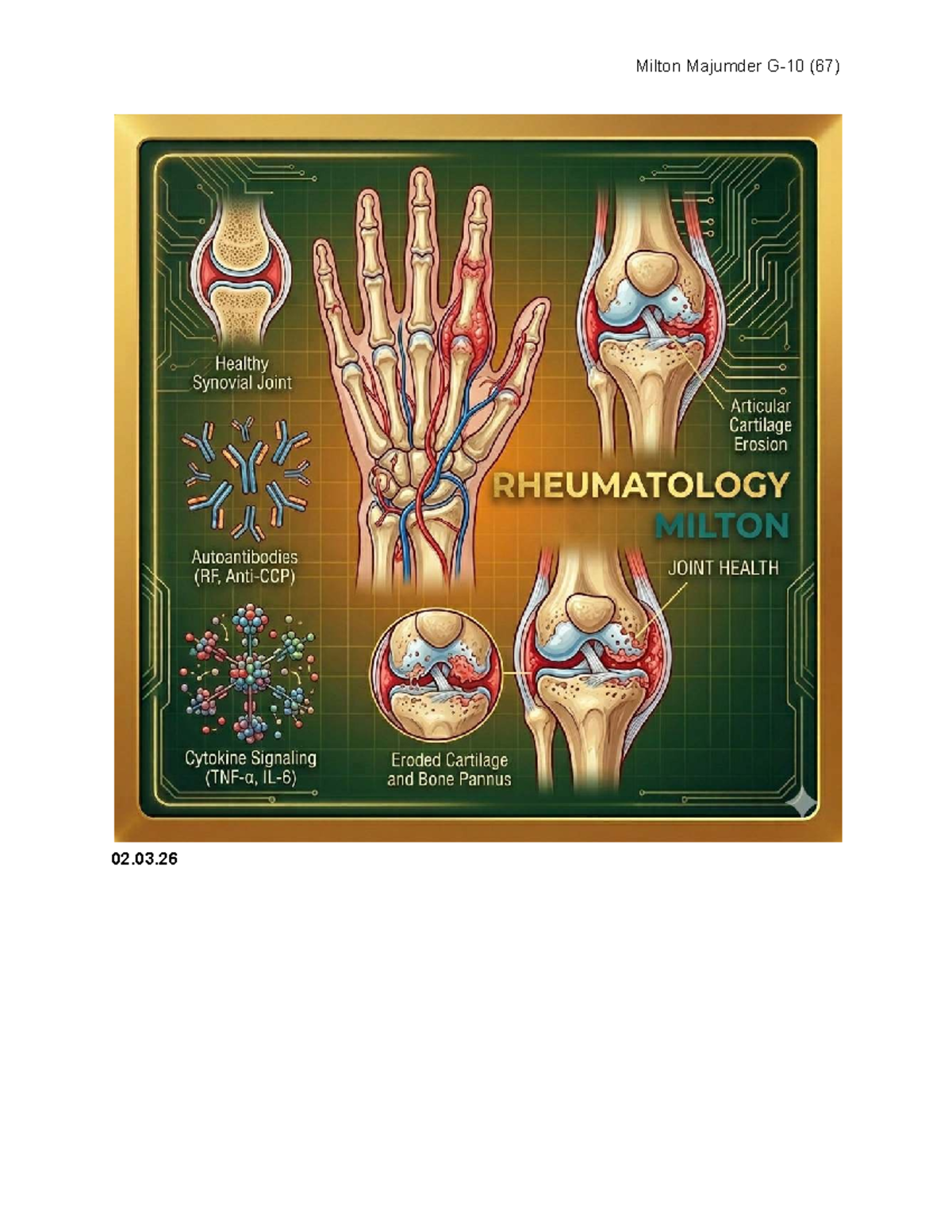 Rheumatology (67) - Comprehensive Medical Notes on Arthritis and SLE ...