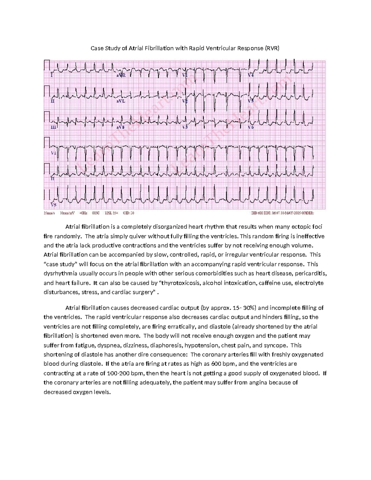 Case Study: Atrial Fibrillation with Rapid Ventricular Response (RVR ...