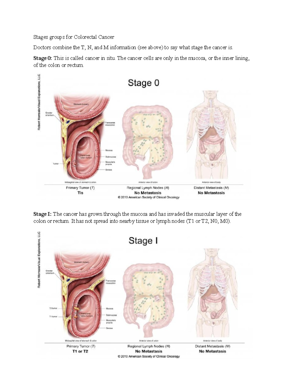 Colorectal Cancer Staging Notes: Understanding TNM System & Metastasis ...