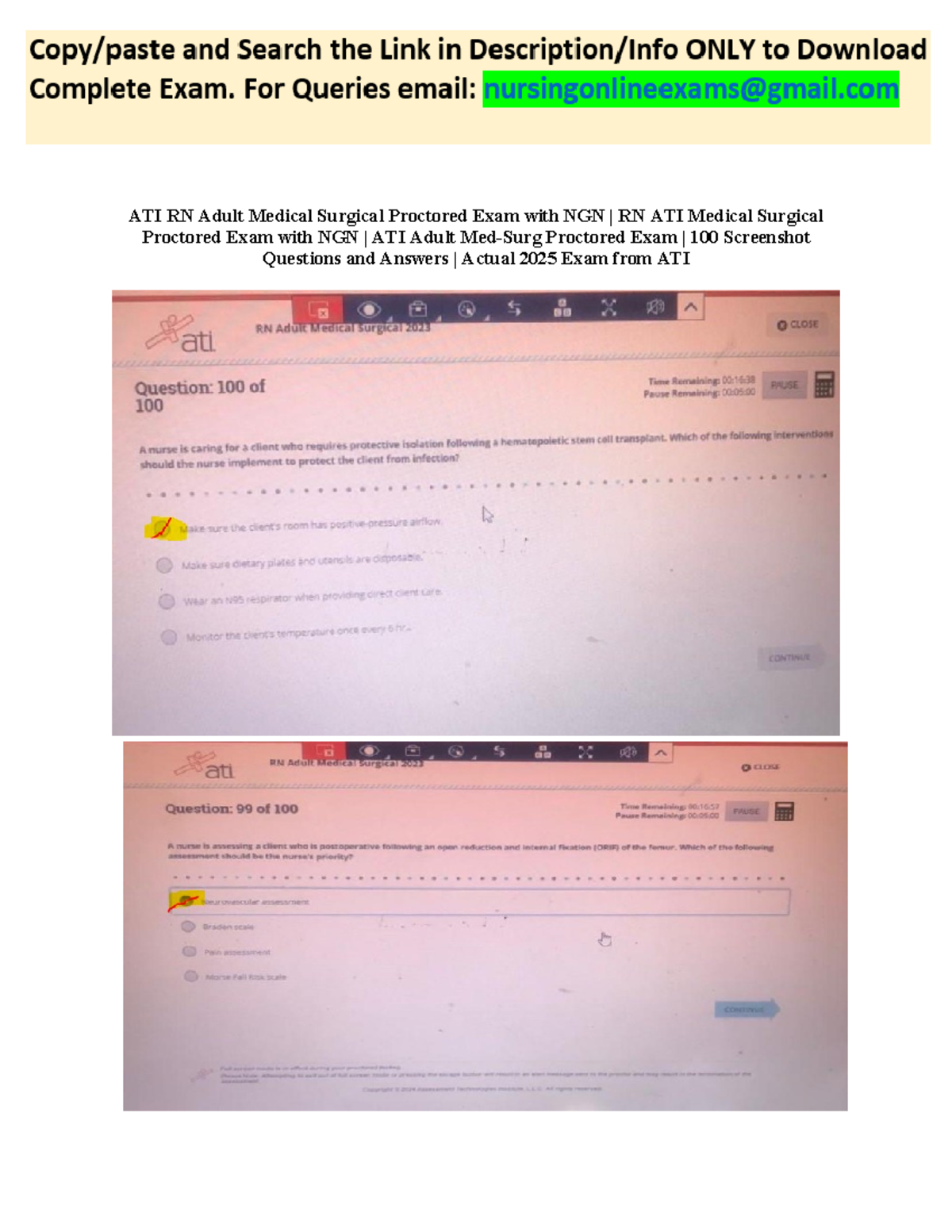 ATI Medical Surgical 20242025 Proctored Exam - 100 Screenshot Questions ...