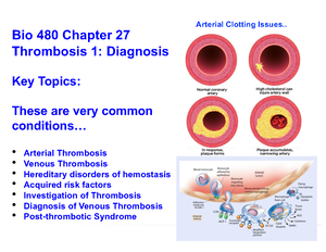 BIO480 Hematology Chapter 19 Hodgkin Lymphoma (HL) - CT Scan 1st ...