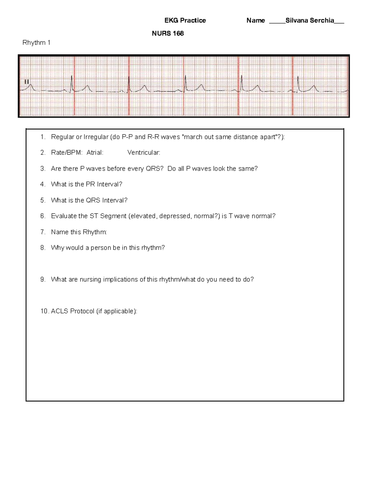 EKG Assignment: NURS 168 Rhythm Analysis and Nursing Implications - Studocu
