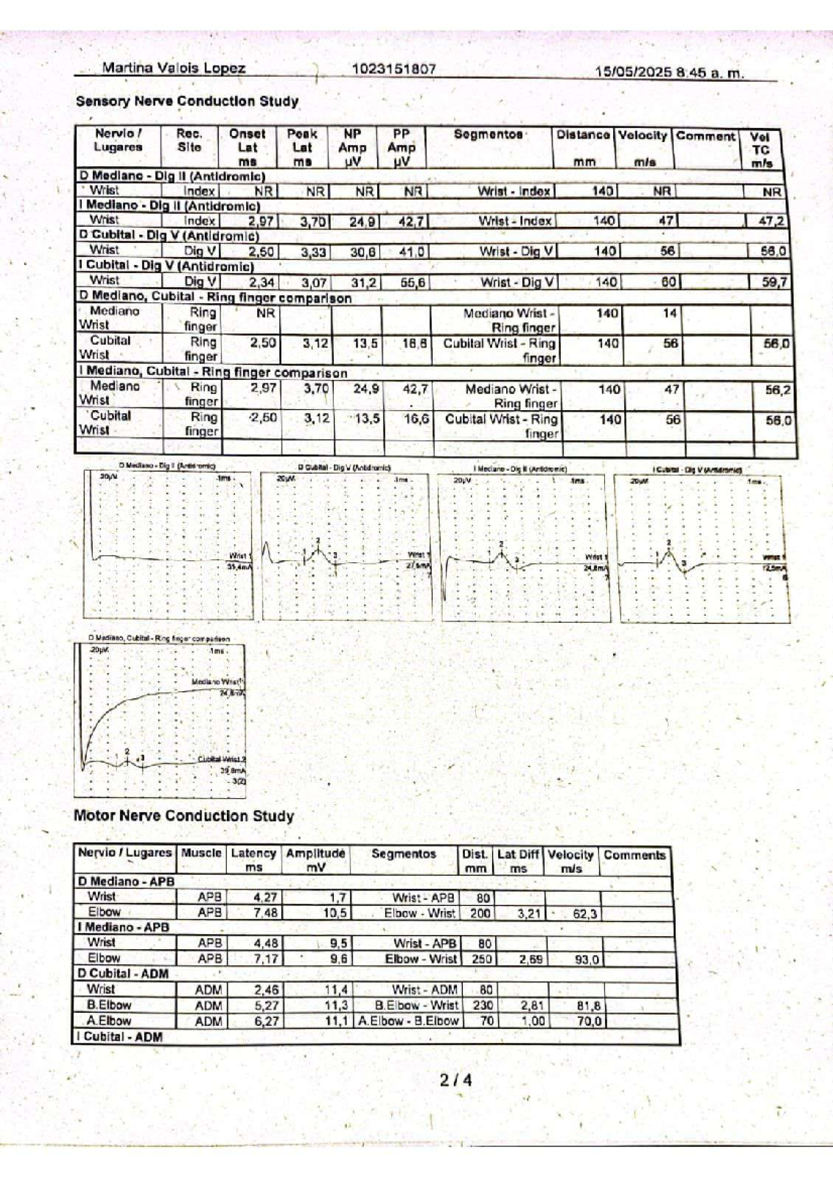 Sensory and Motor Nerve Conduction Study Report 1023151807 - Studocu
