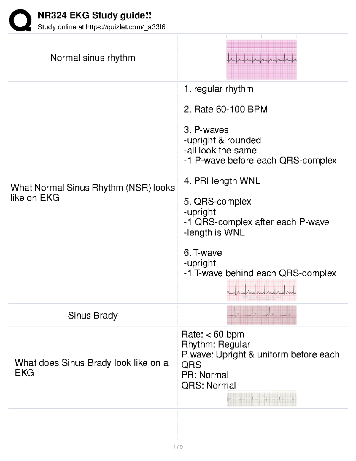 NR324 EKG Study Guide Quizlet: Understanding Heart Rhythms & Treatments ...