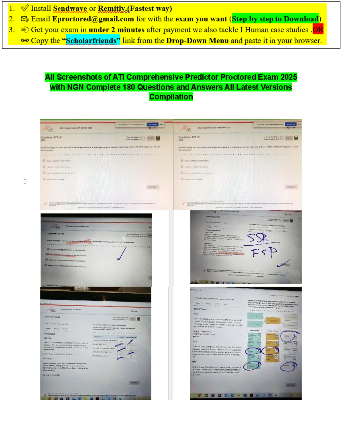 Actual ATI RN Comprehensive Predictor Proctored Exam 2025 with NGN ...