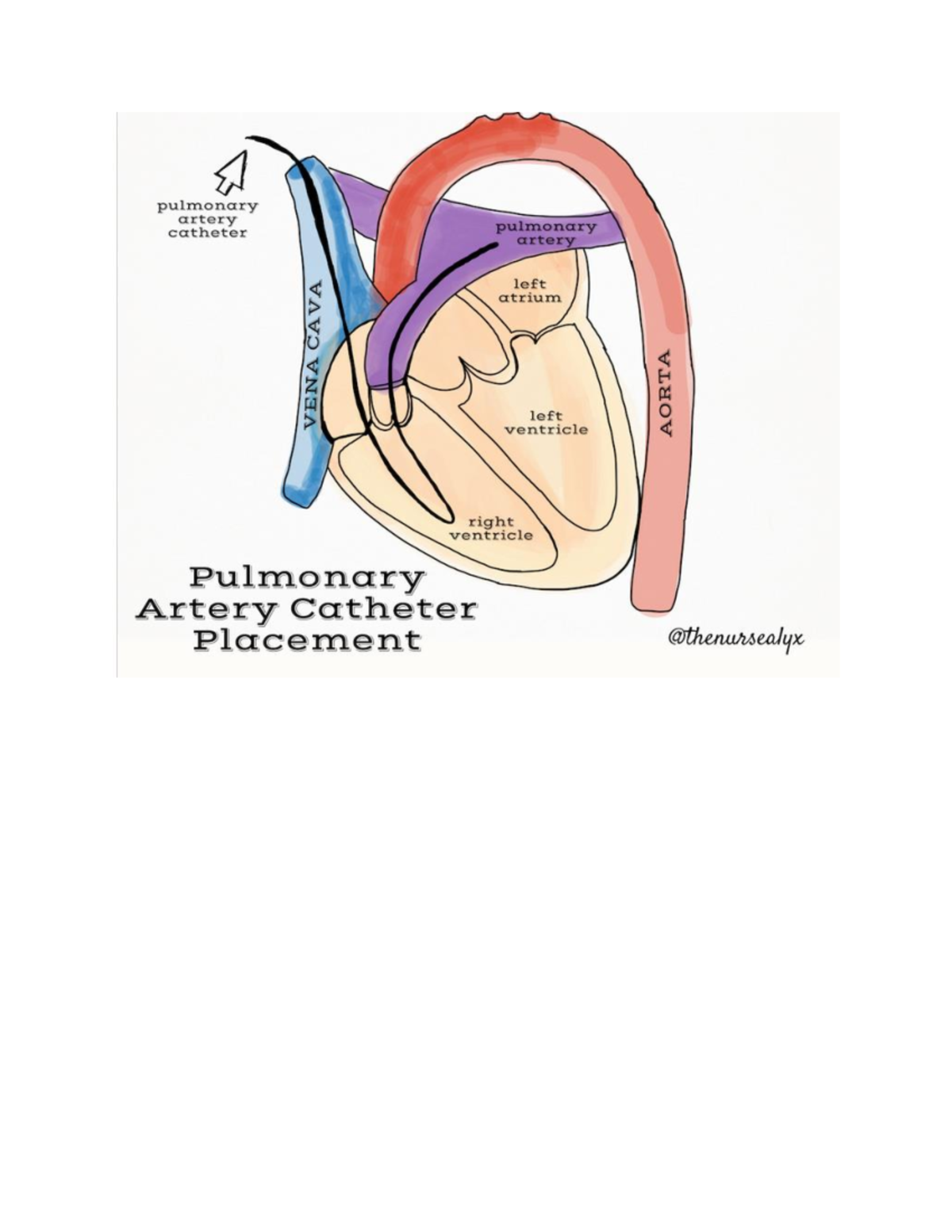 Pulmonary artery catheter Image - NUR 2416 - Studocu