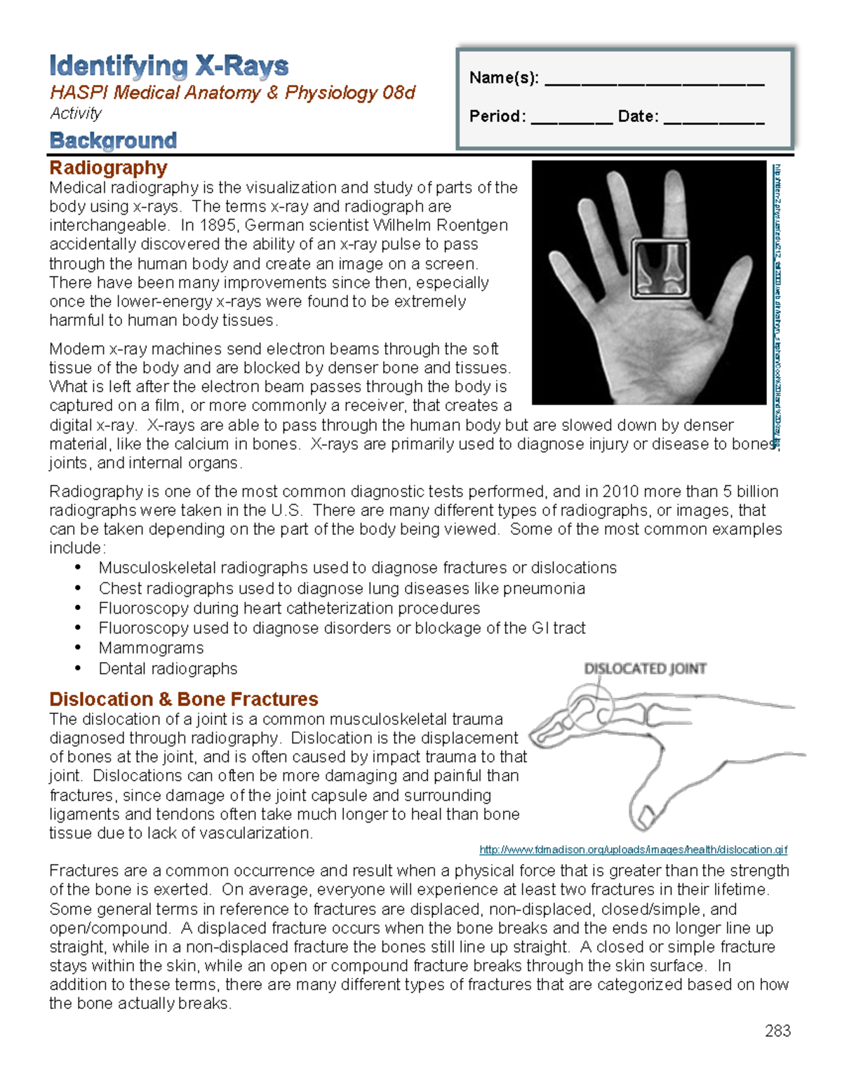 Anatomy X-rays assignment - HASPI Medical Anatomy & Physiology 08d ...