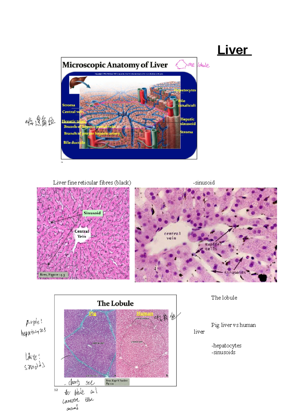 Histology practical exam part 2 - Liver Liver fine reticular fibres ...