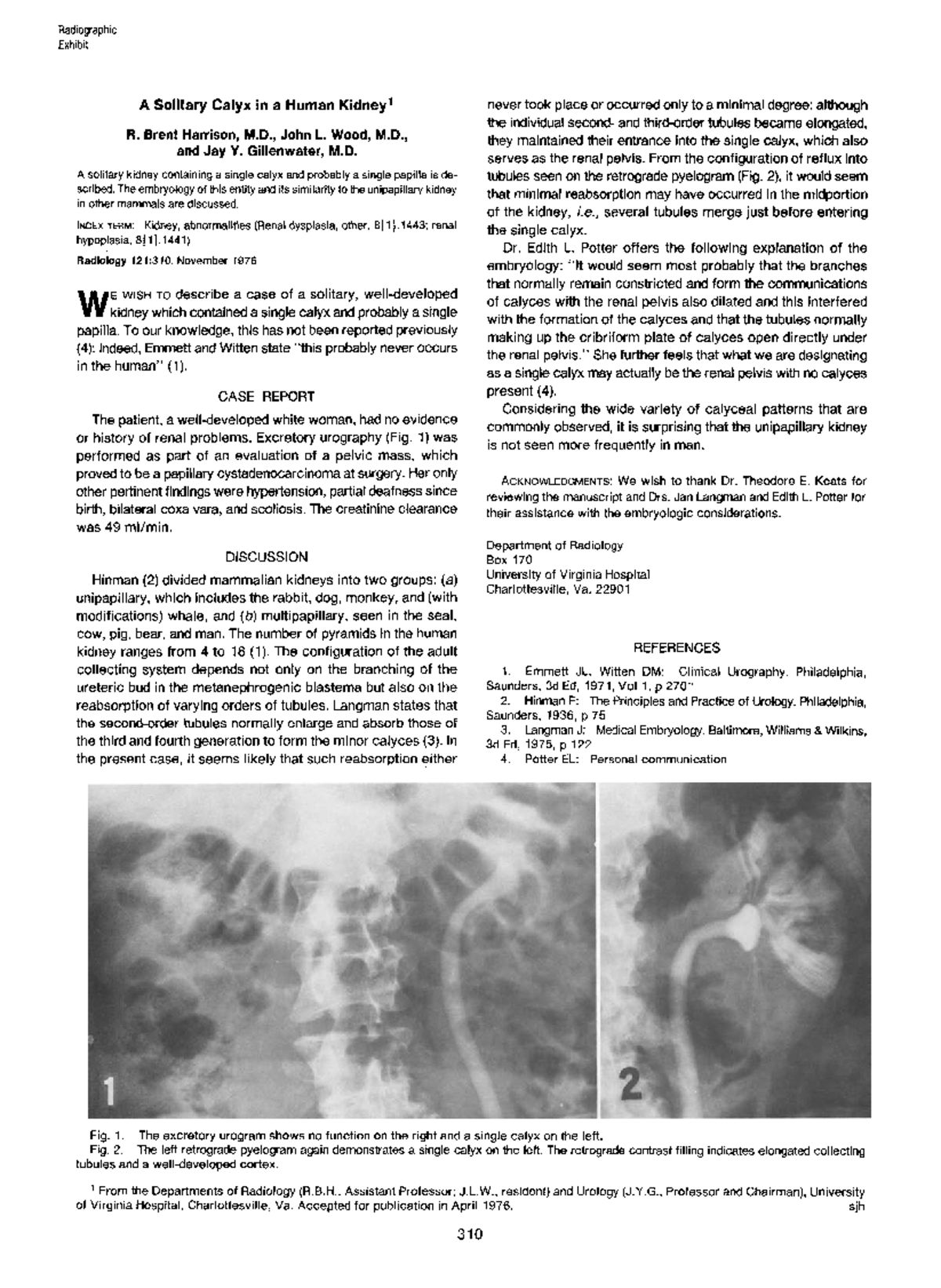 A Solitary Calyx in a Human Kidney - Brent Harrison, M., John L. Wood ...