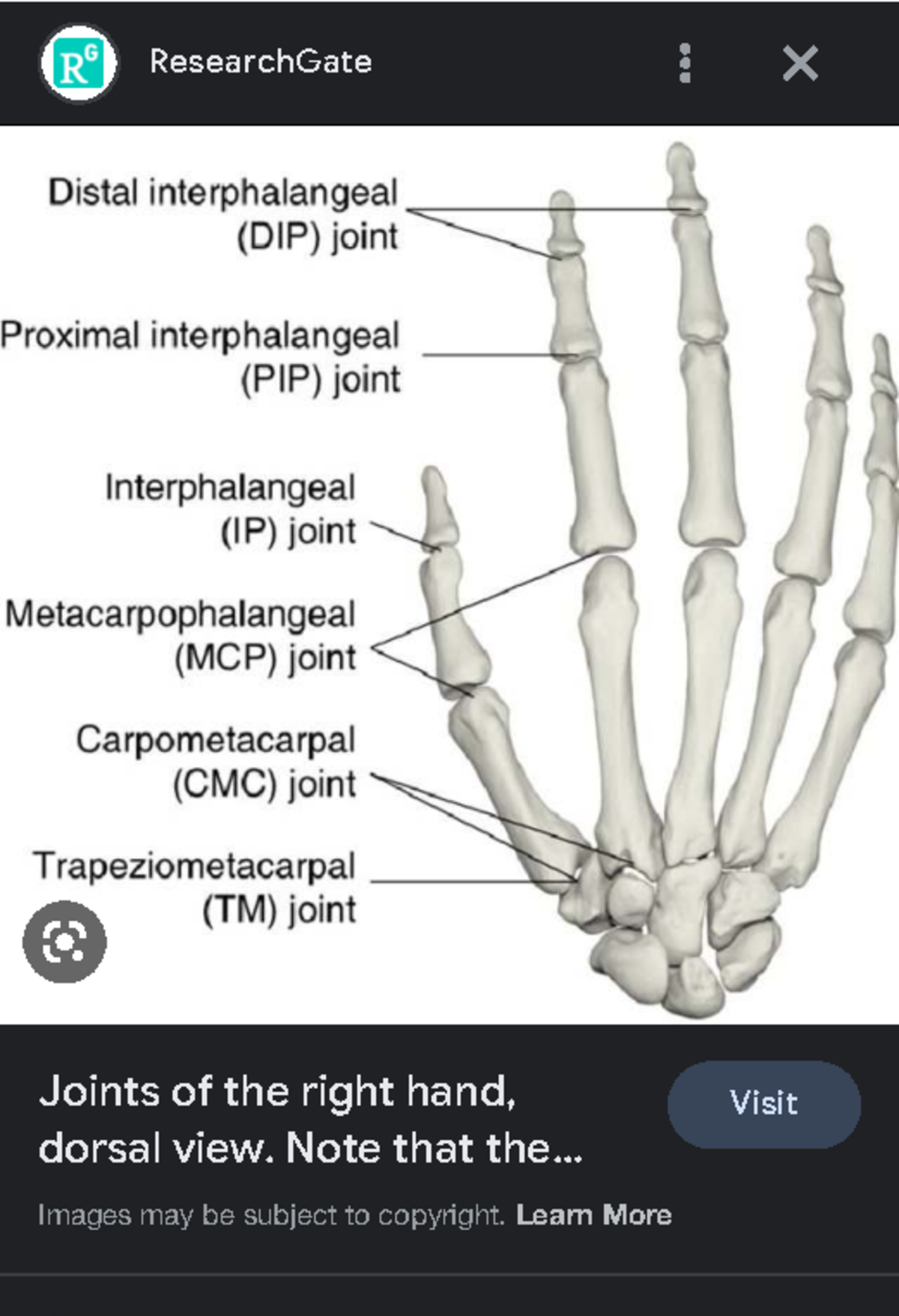 Finger brakes in the top knuckle - Google Search - ResearchGate Joints ...
