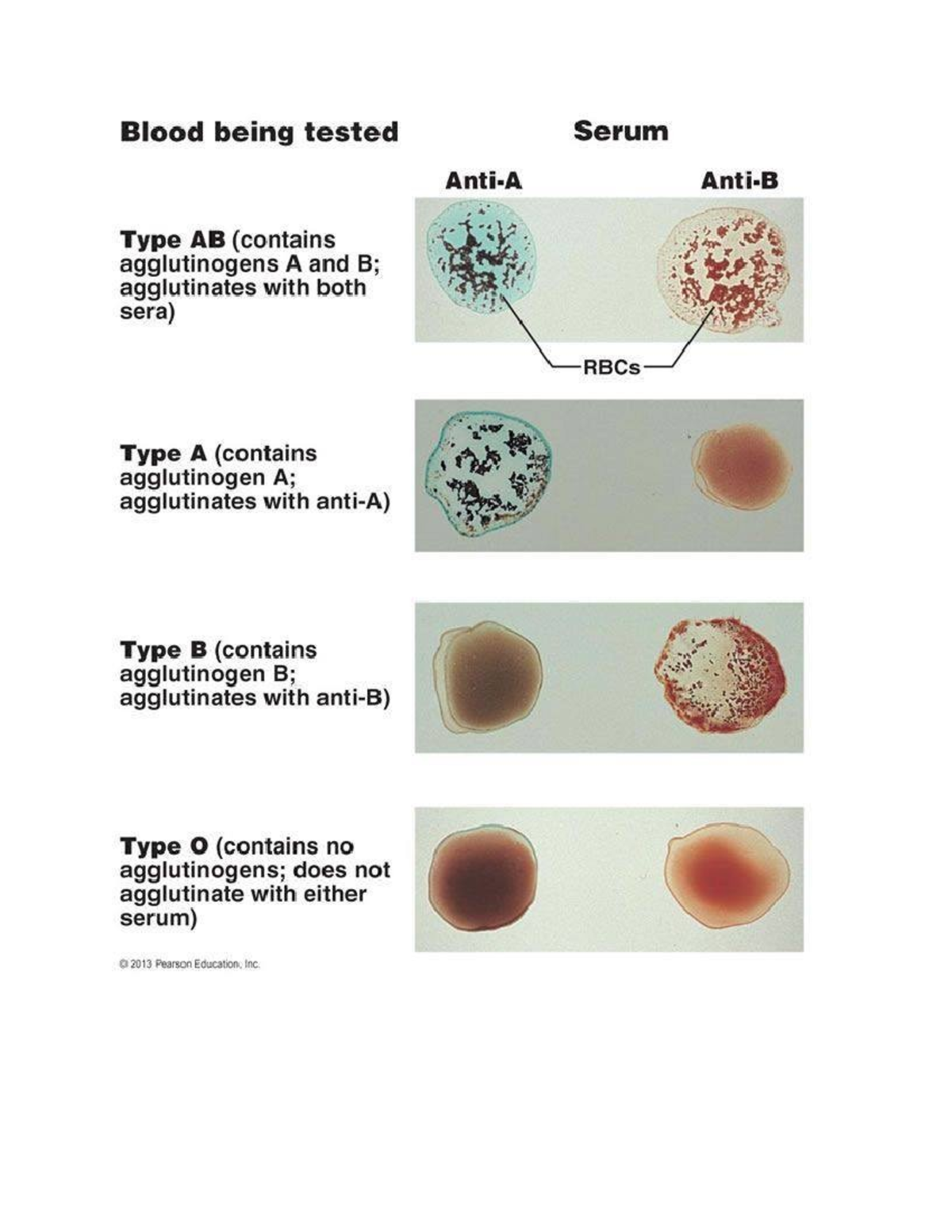 Blood types - BIOL 2185 - Blood being tested Serum Type AB (contains ...