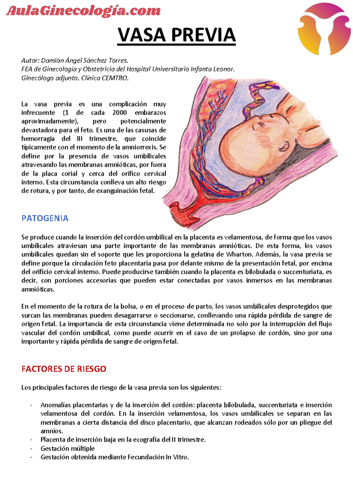 Vasa Previa: Diagnóstico y Manejo en Ginecología (Ciclo de Ginecología ...