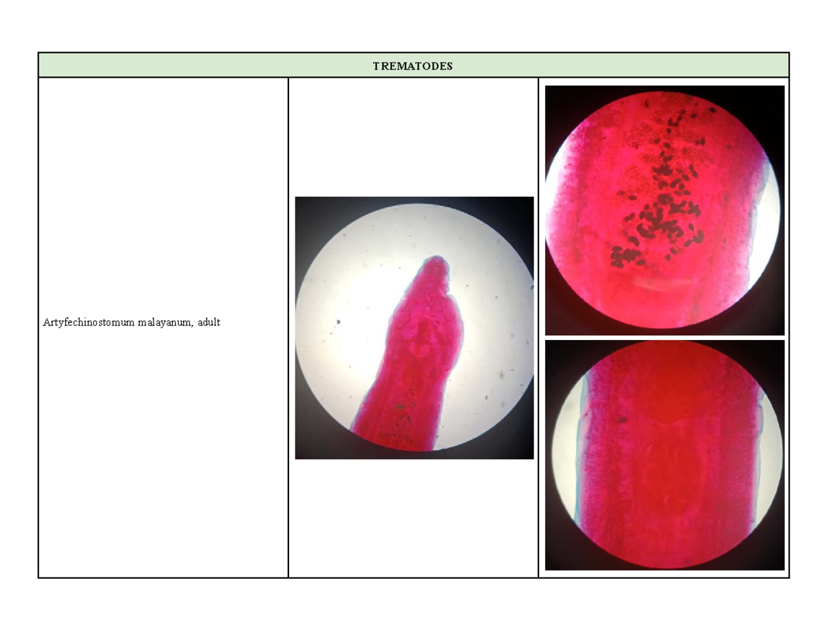Trematodes [Table] Microscope Pictures - Medical Laboratory Science ...