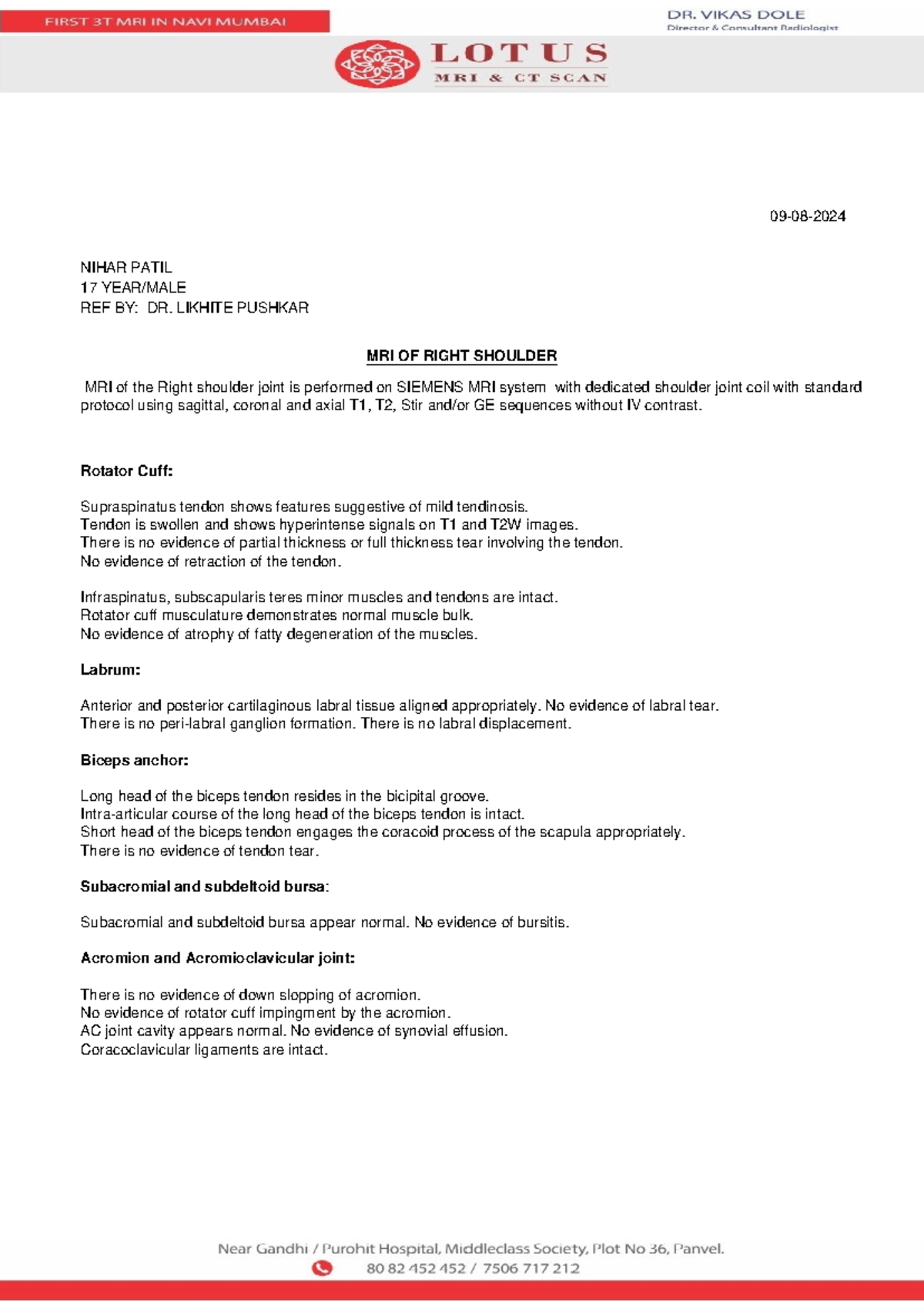 MRI report of right shoulder - JSSN - Studocu