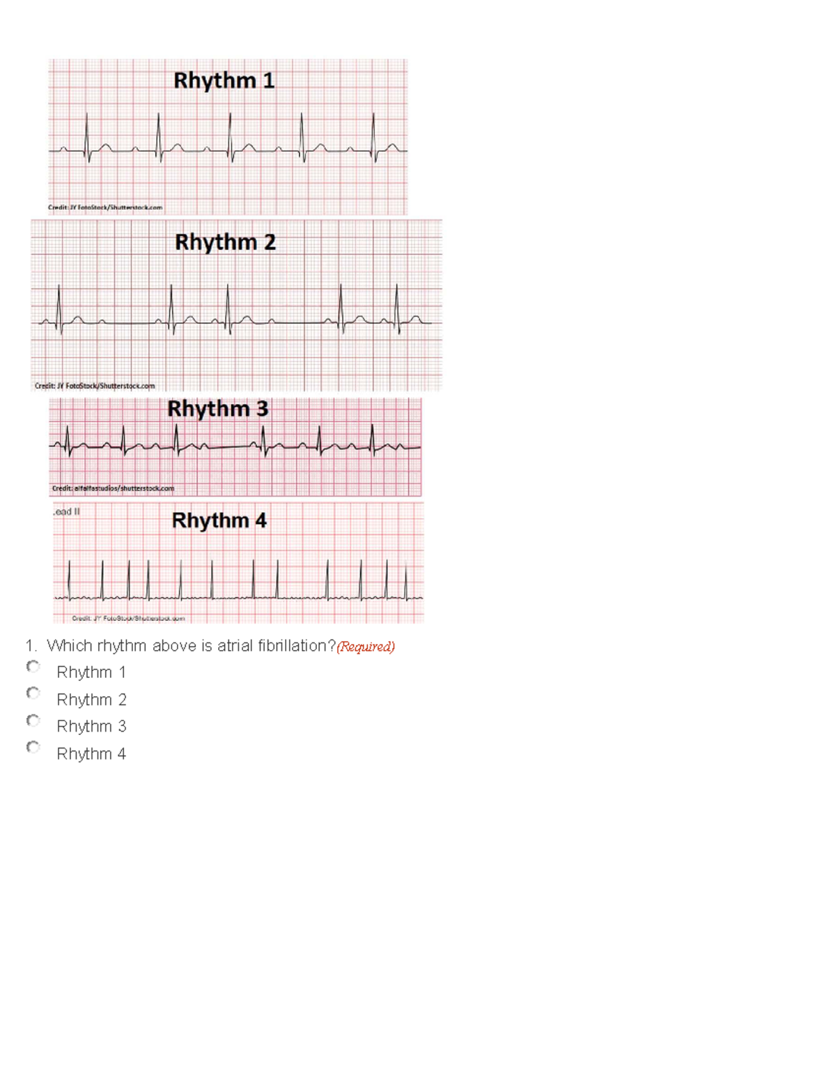 ECG Rhythm Identification: Atrial Fibrillation Analysis (Extra Credit ...