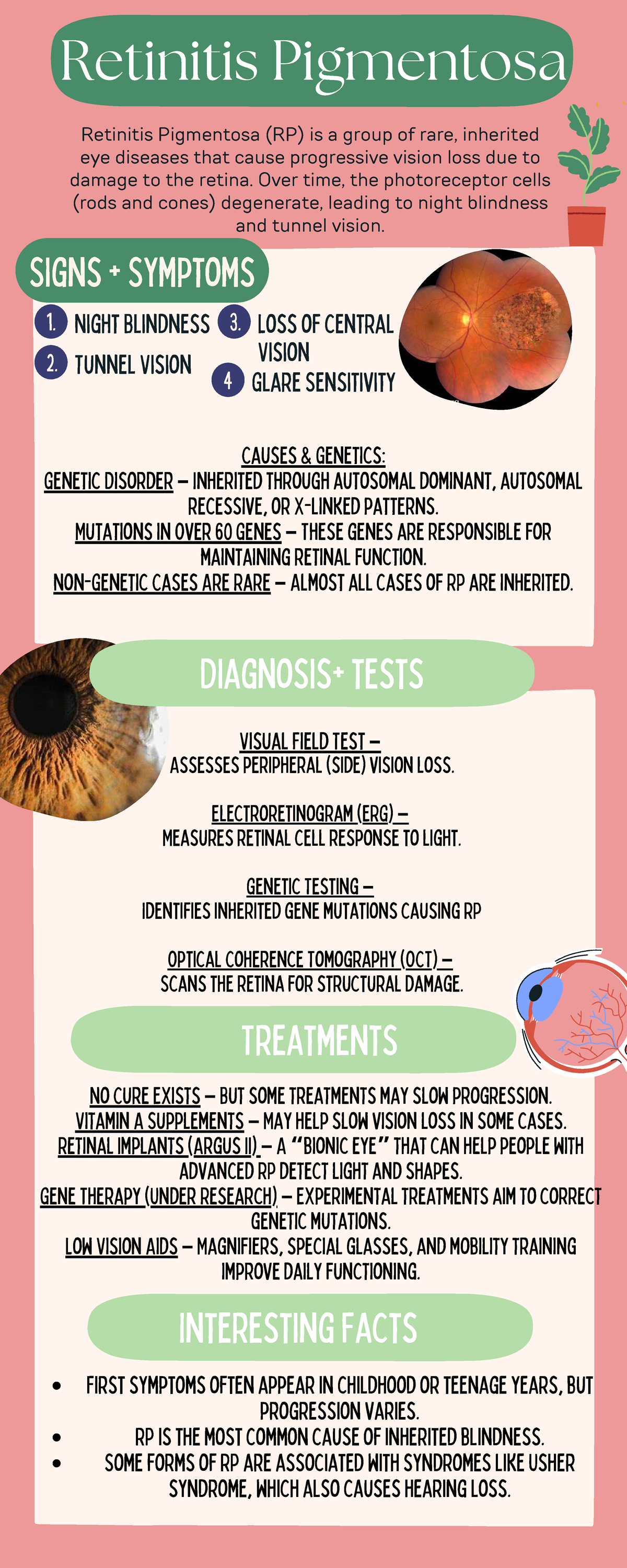 Retinitis Pigmentosa - Informational Poster! - 1. Night Blindness 2 ...