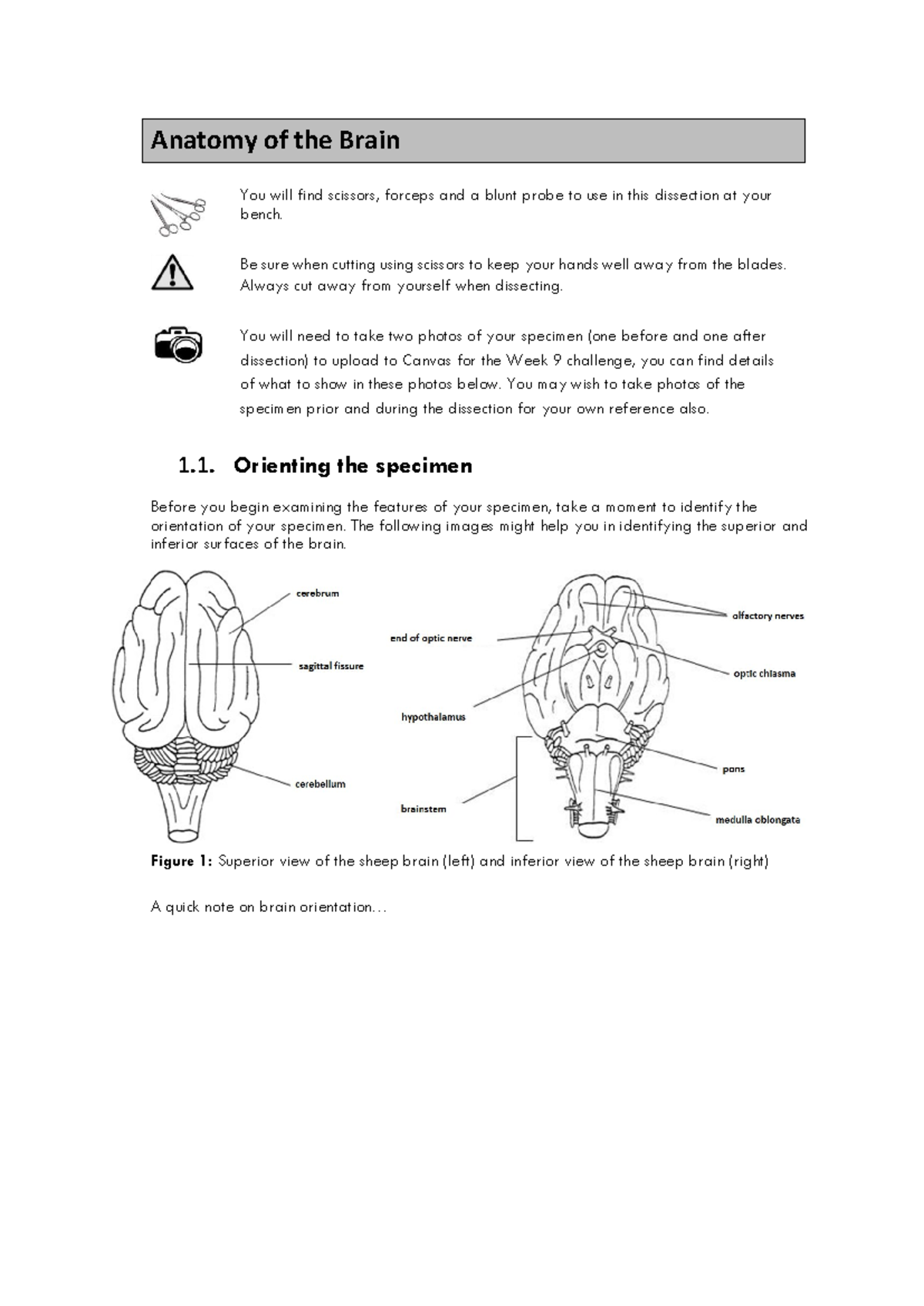 Brain Dissection Guide: Practical 2 Instructions & Labels - Studocu