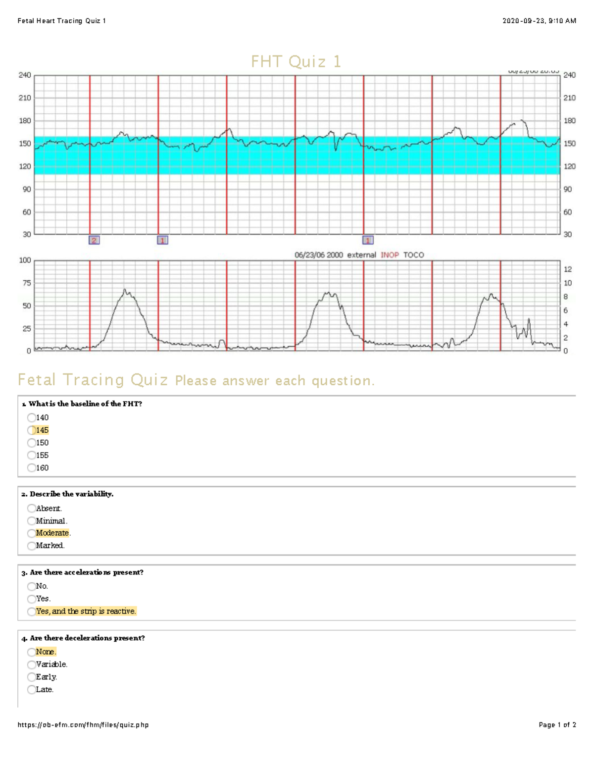 Fetal Heart Tracing Quiz 1 (OB 101): Assessment Questions - Studocu