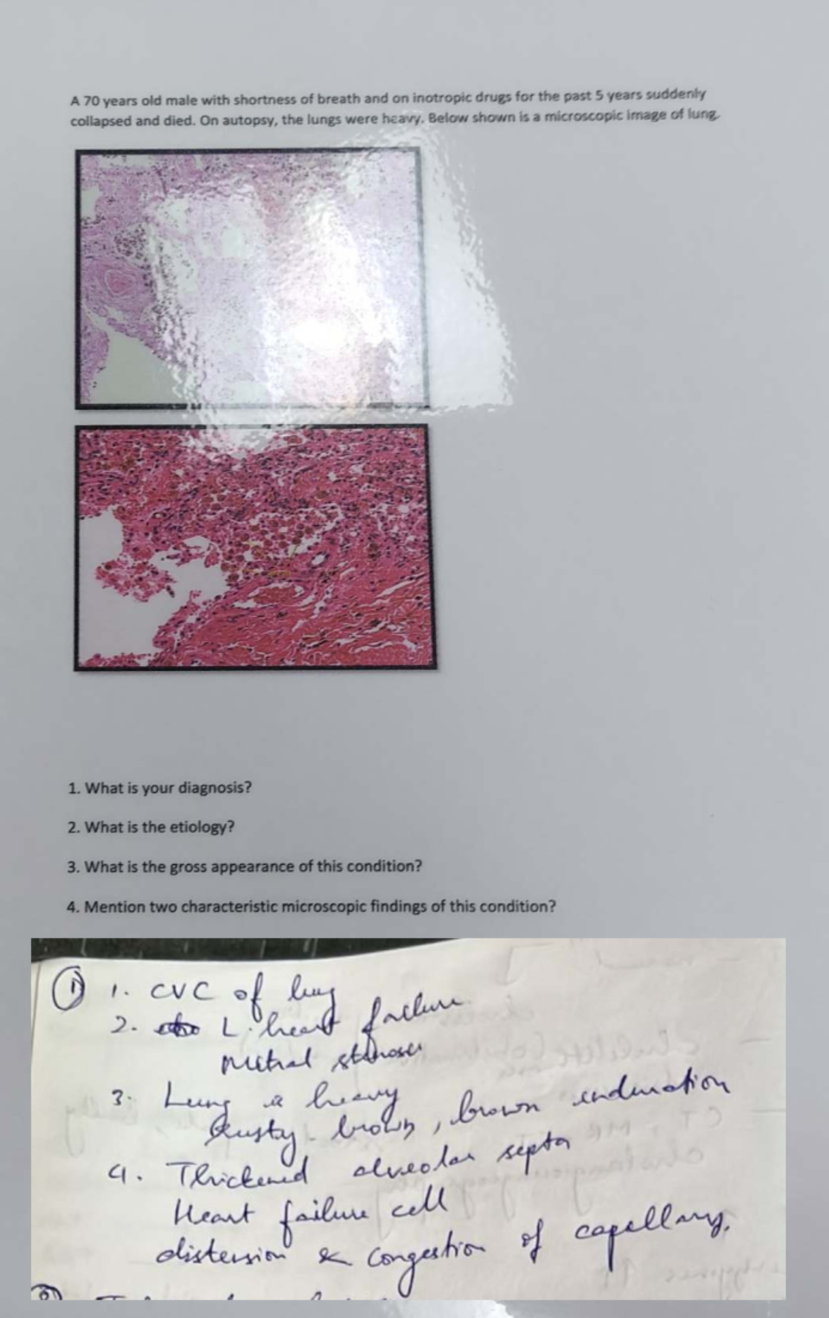 Pathology Charts Compilation for OSPE: Diagnosis & Microscopic Findings ...
