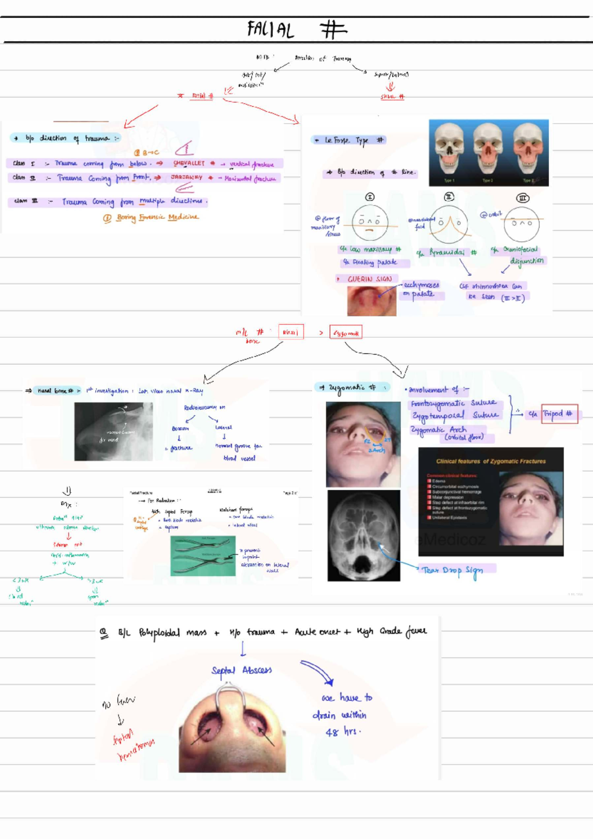 Head and neck trauma notes for FALIAL course: comprehensive overview ...