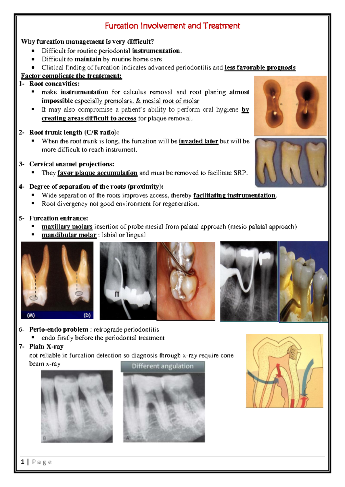 Furcation Involvement: Challenges, Classification, and Treatment ...