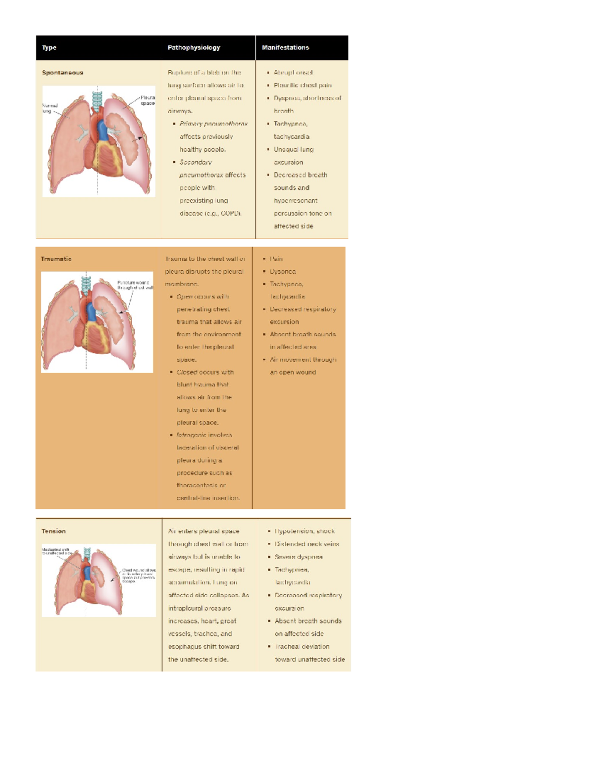 Nursing Care Guidelines for Chest Tube Insertion & Management - Studocu