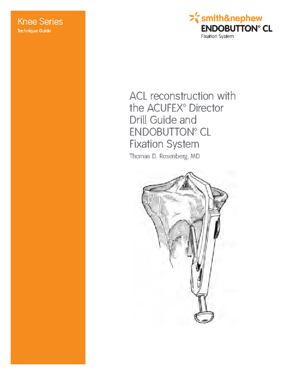 10600026 ACL Reconstruction Technique with ENDOBUTTON CL System - Studocu