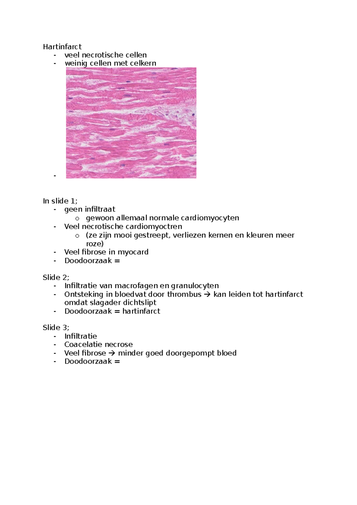 Werkcollege Celpathologie en Ontsteking: Hartinfarct Analyse - Studeersnel