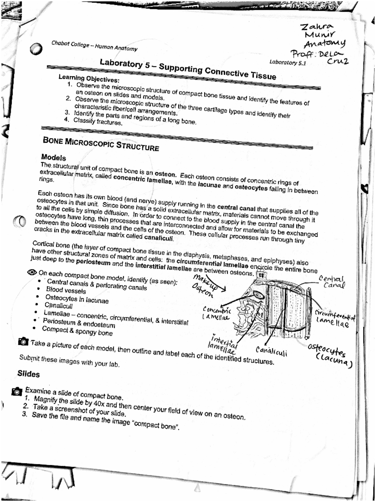 Human Anatomy Lab 5: Compact Bone Structure & Microscopy Guide - Studocu