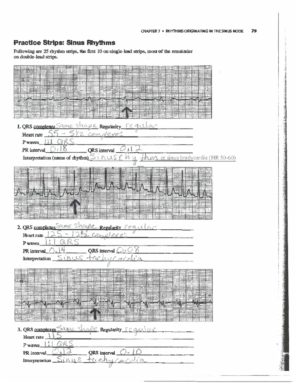 Sinus Rhythm Practice Strips - Chapter 7 EKG Analysis - Studocu