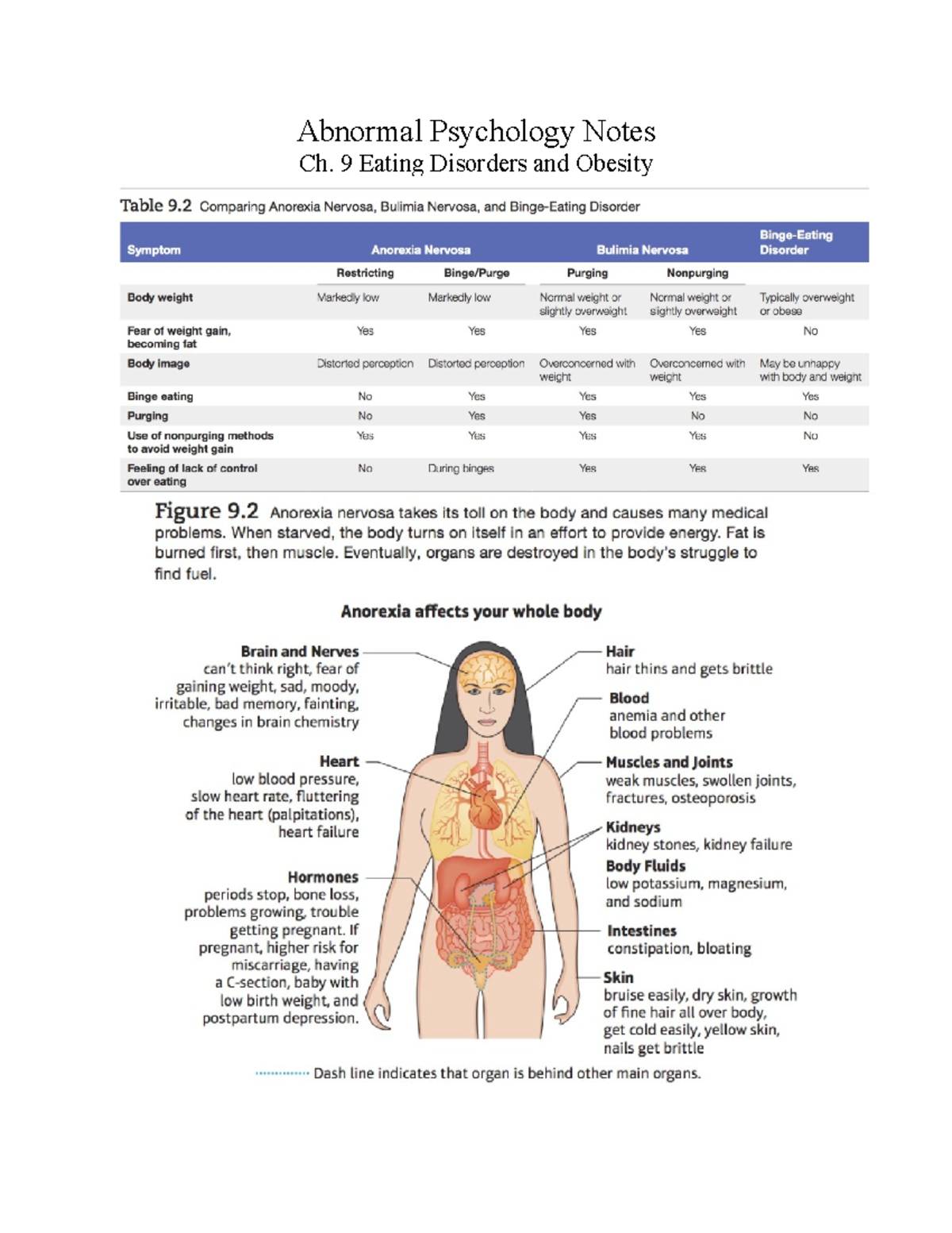 Abnormal Psychology Notes Ch - 9 Eating Disorders and Obesity Bulimia ...