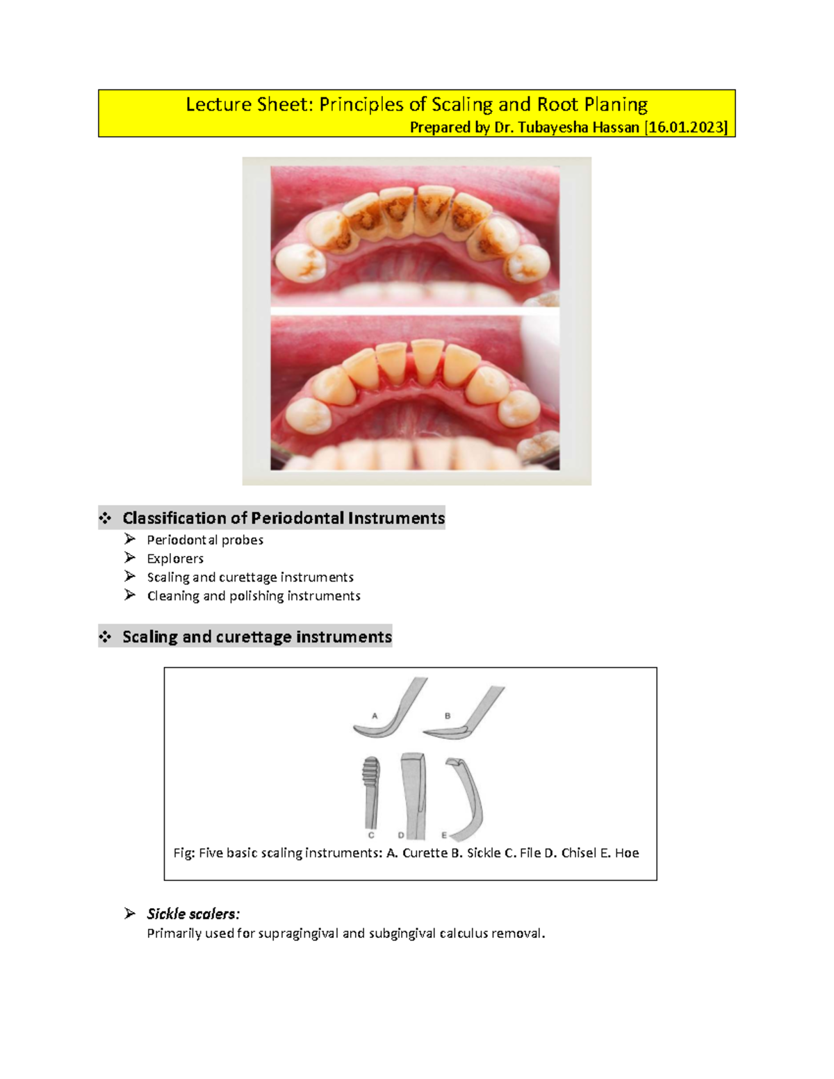 020.gingival enlargement | PDF, image size:1200x1553