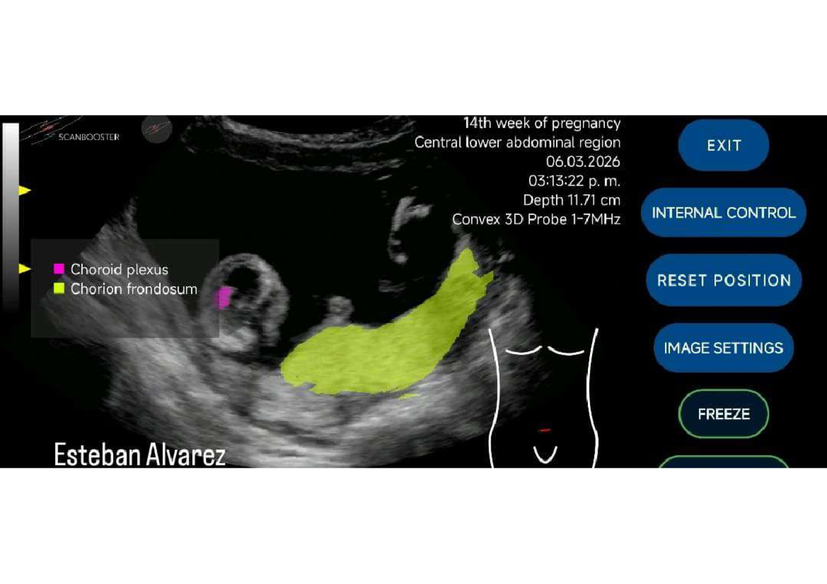 14th Week Pregnancy Scan Report - SCANBOOSTER Images - Studocu