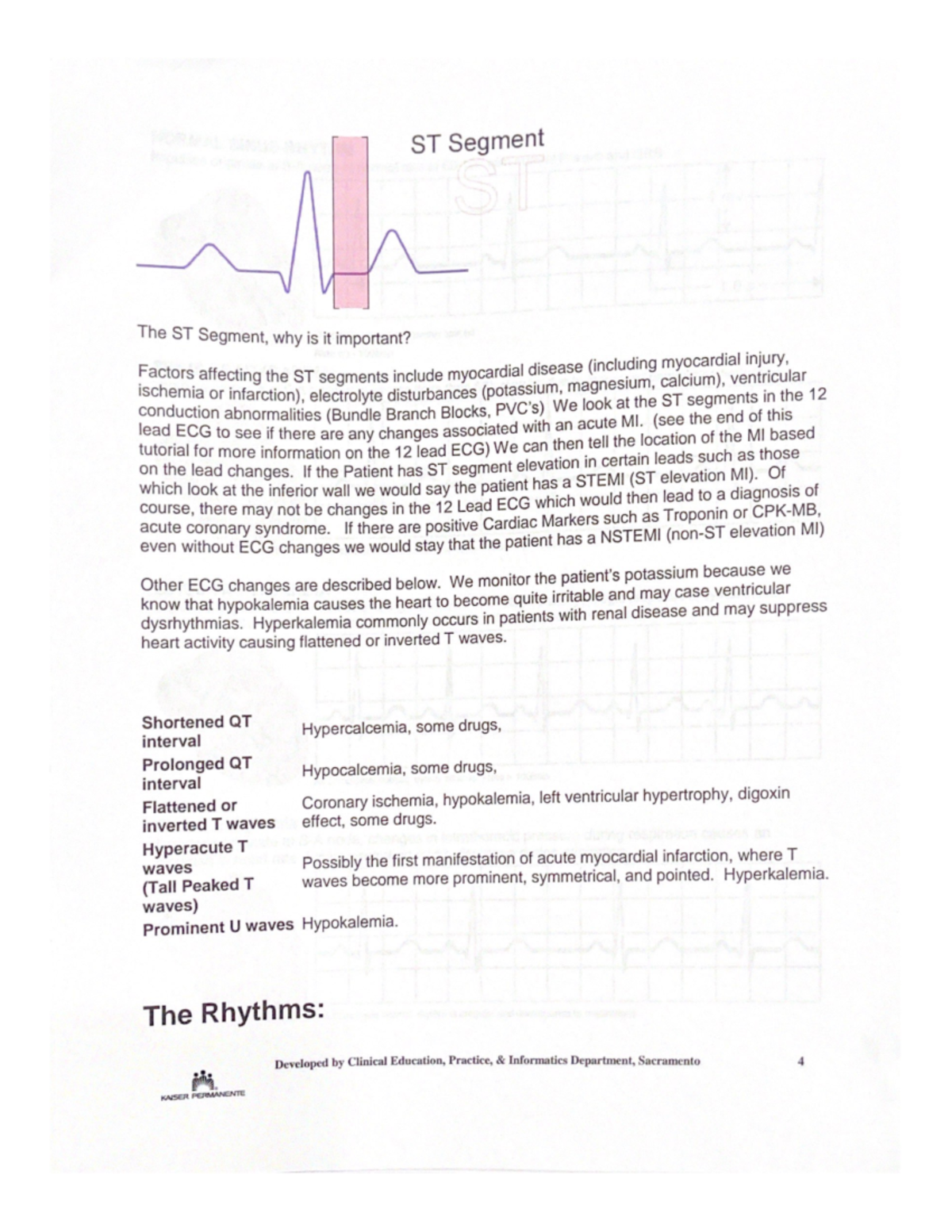 Cardiac Telemetry Notes: Understanding ST Segments & Arrhythmias - Studocu