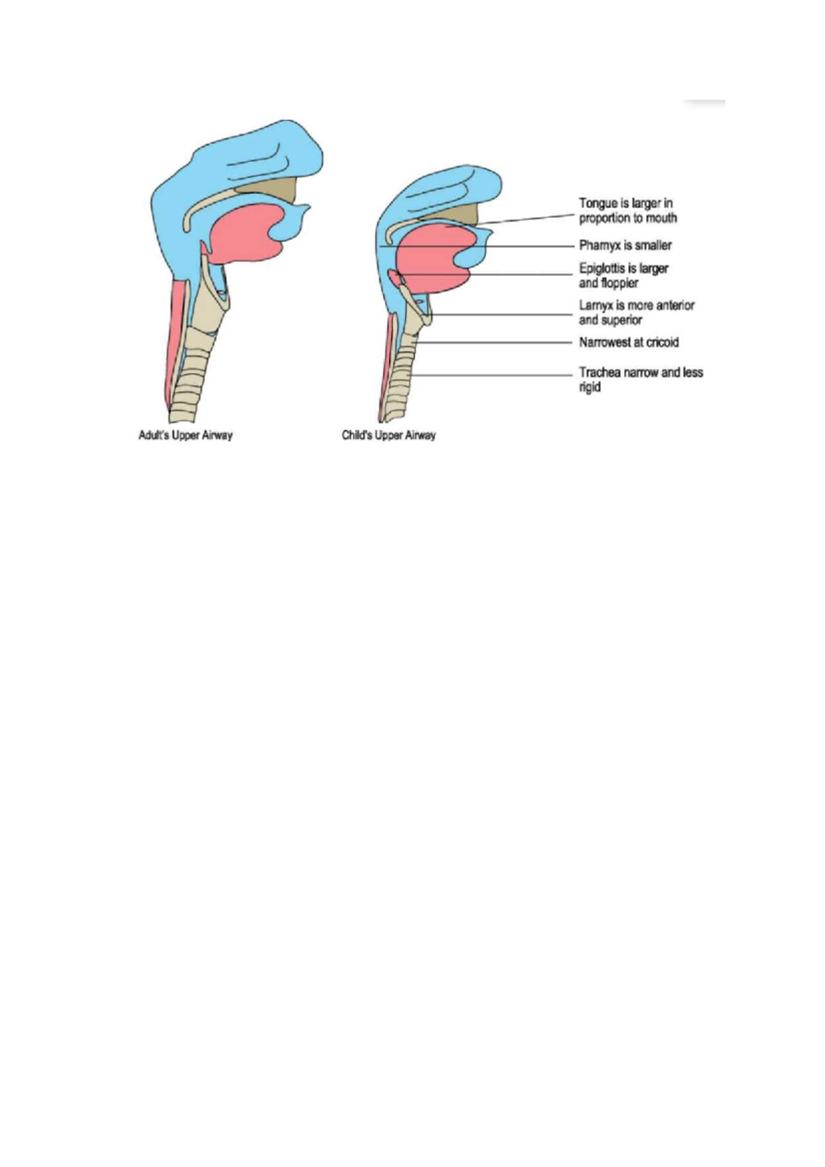 Farynx - lesmateriaal - Coschap KNO - Tongue is larger in proportion to ...