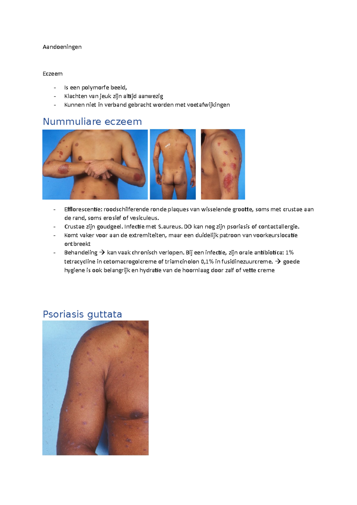 Aandoeningen - Dermatosen en Behandelingen: Eczeem, Psoriasis, Schurft ...
