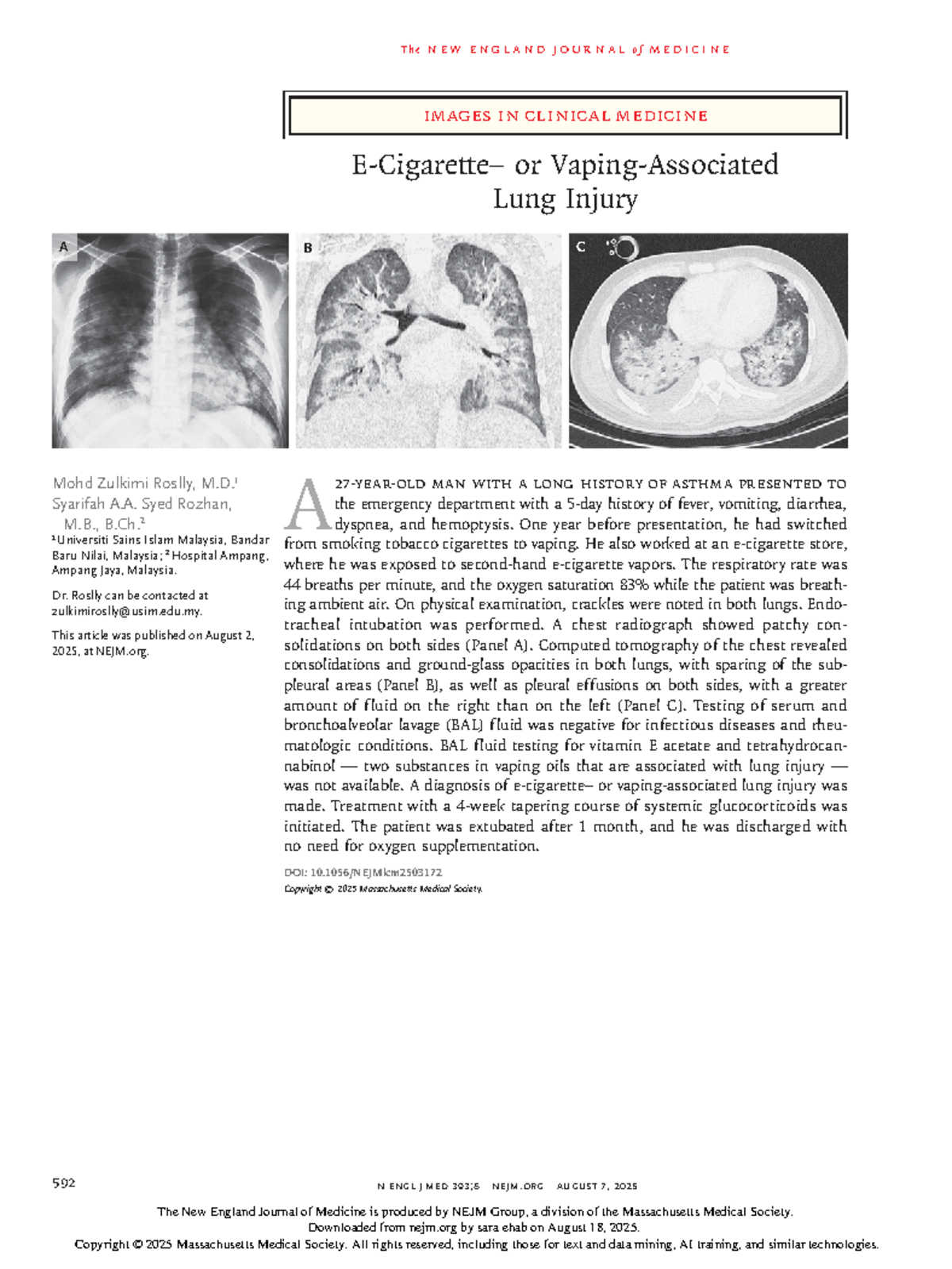 NEJM Case Study: Lung Injury Diagnosis and Treatment (NEJMicm 2503172 ...