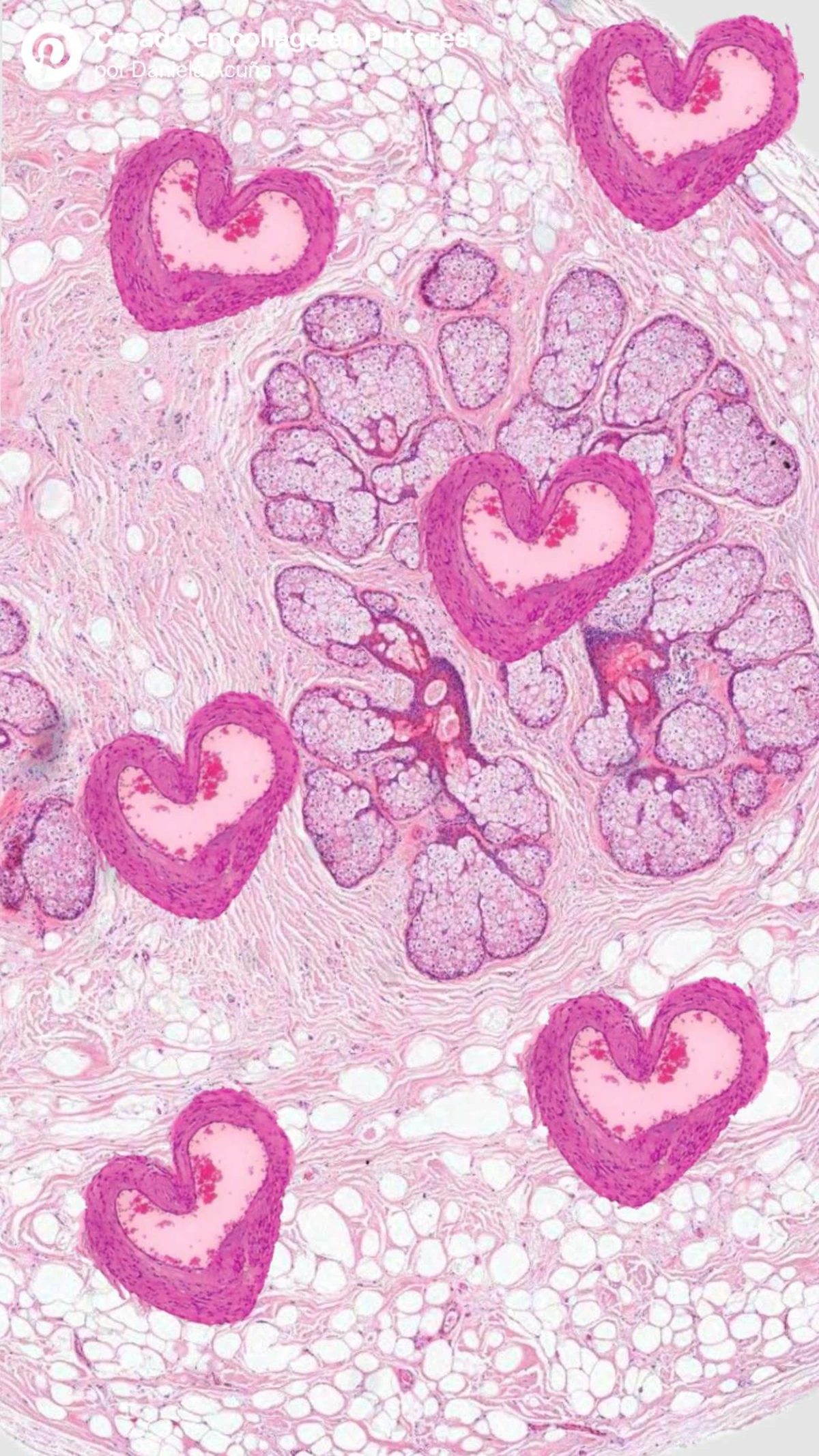 Exploring the Retroauricular Transmeatal Approach: Benefits ...