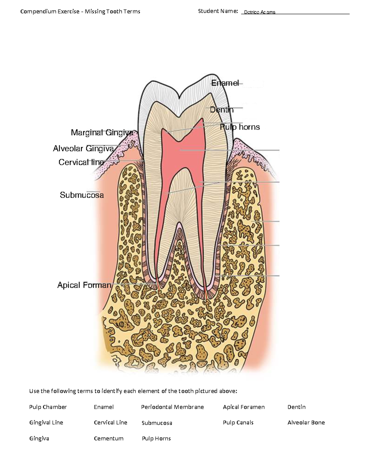 Compendium Exercise - Missing Tooth Terms for Dental Studies - 100 ...