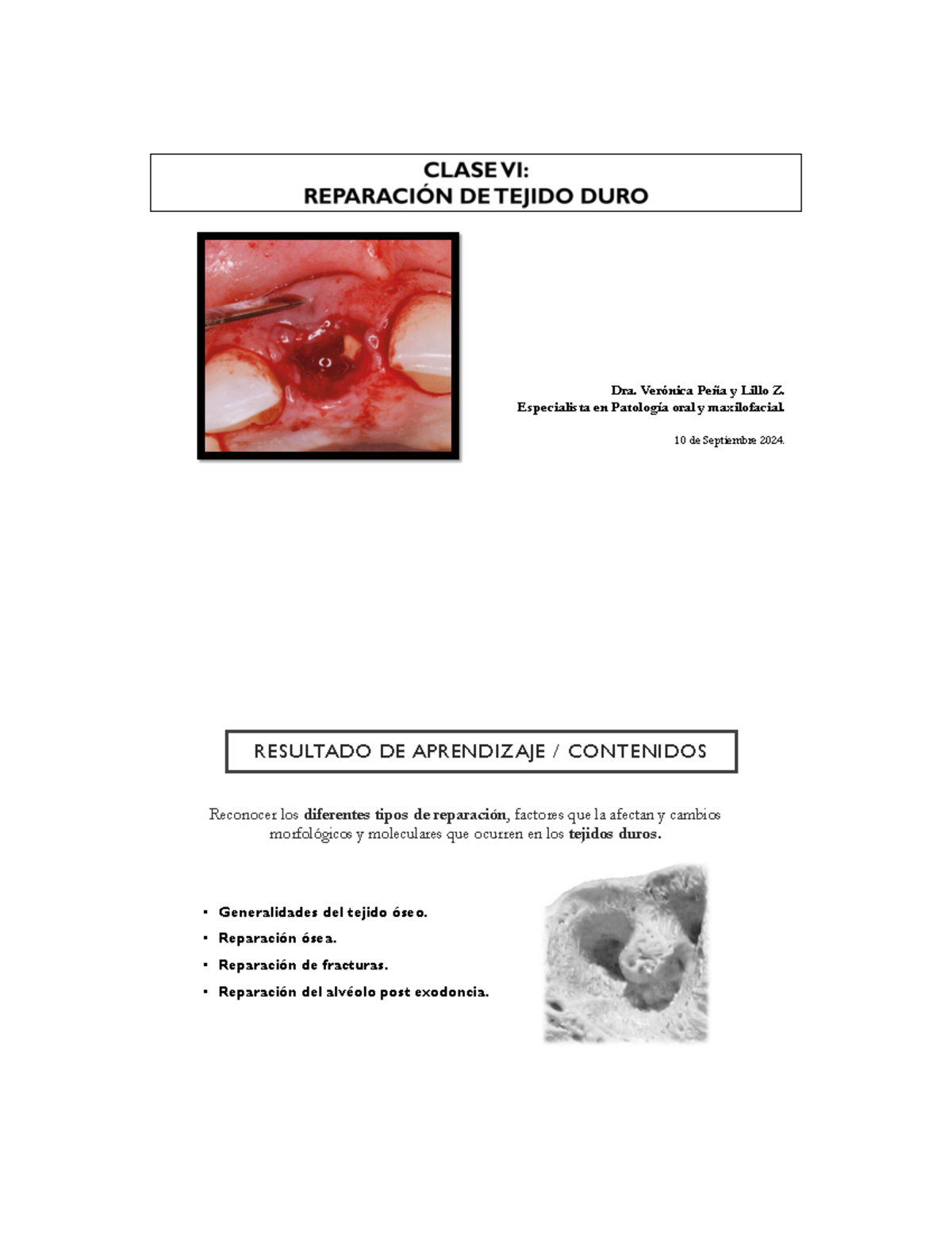 Clase+VI+-+2024+-+Reparacio%CC%81n+de+tejido+duro - Dra. Verónica Peña ...